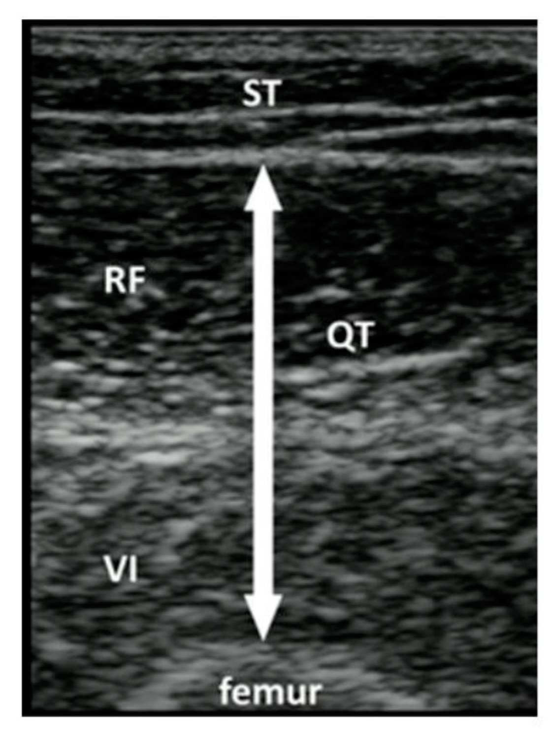 Jcm 12 01251 g002 Jcm 12 01251 g002