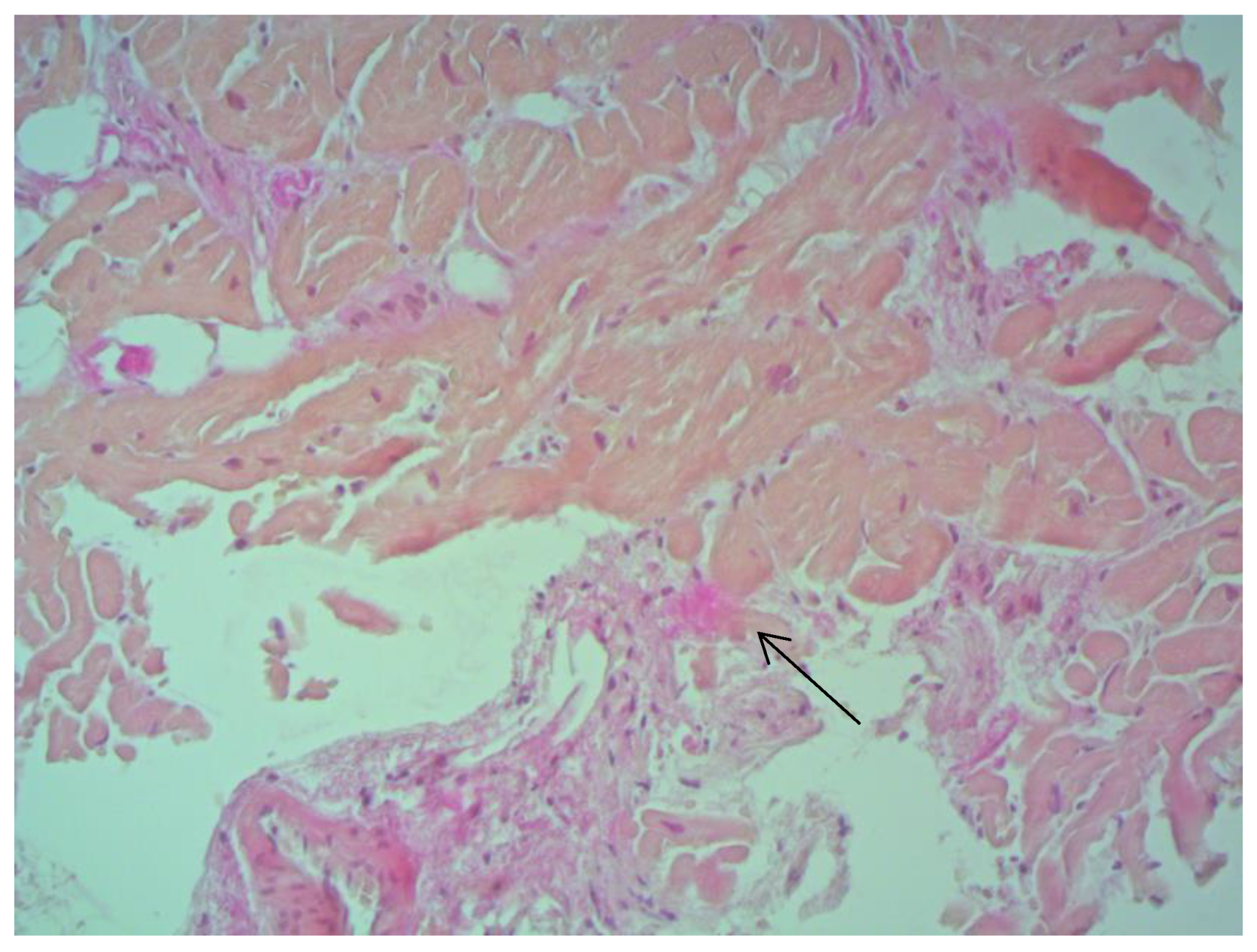 Jcm 12 01254 g002 550