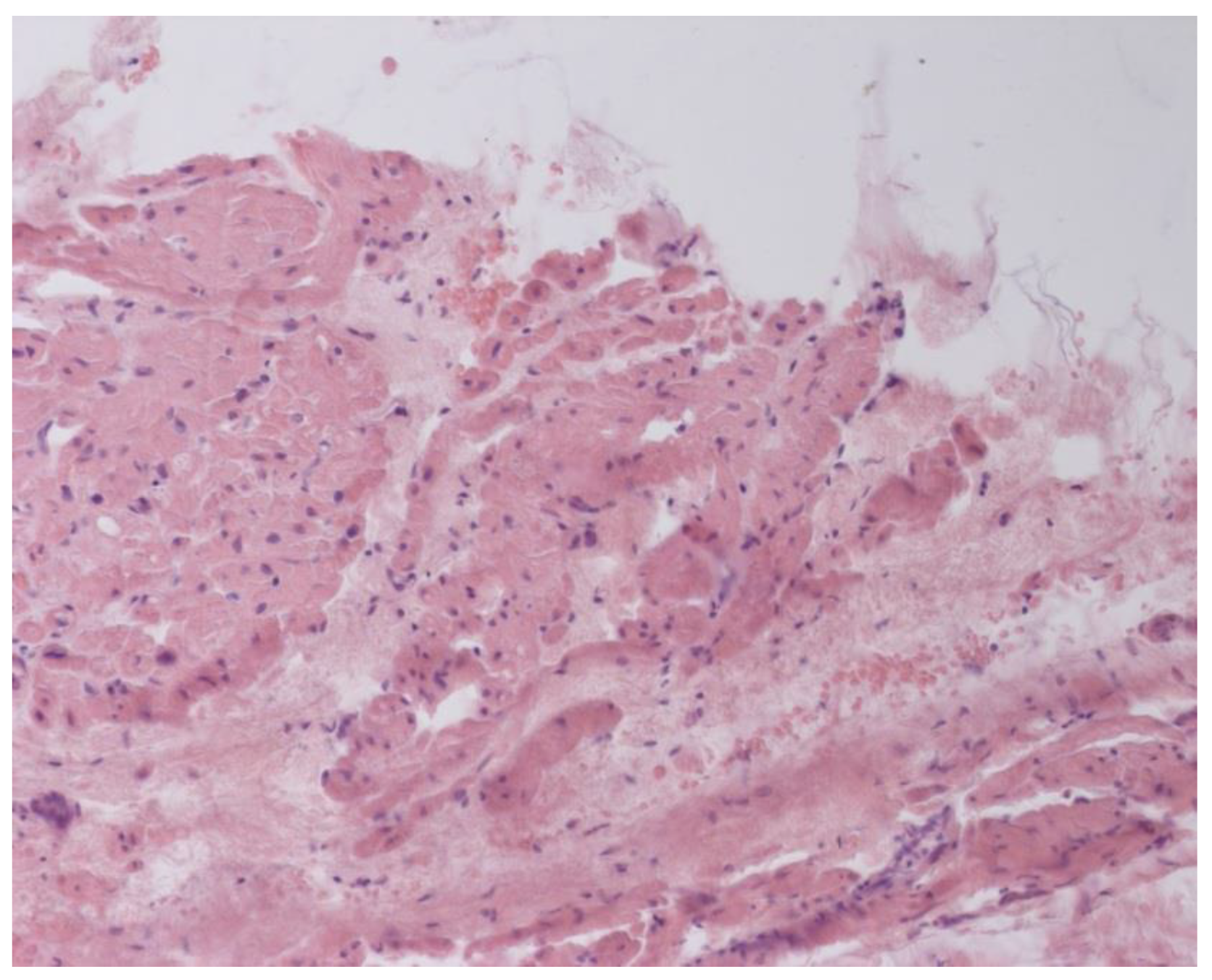 Jcm 12 01254 g005 550