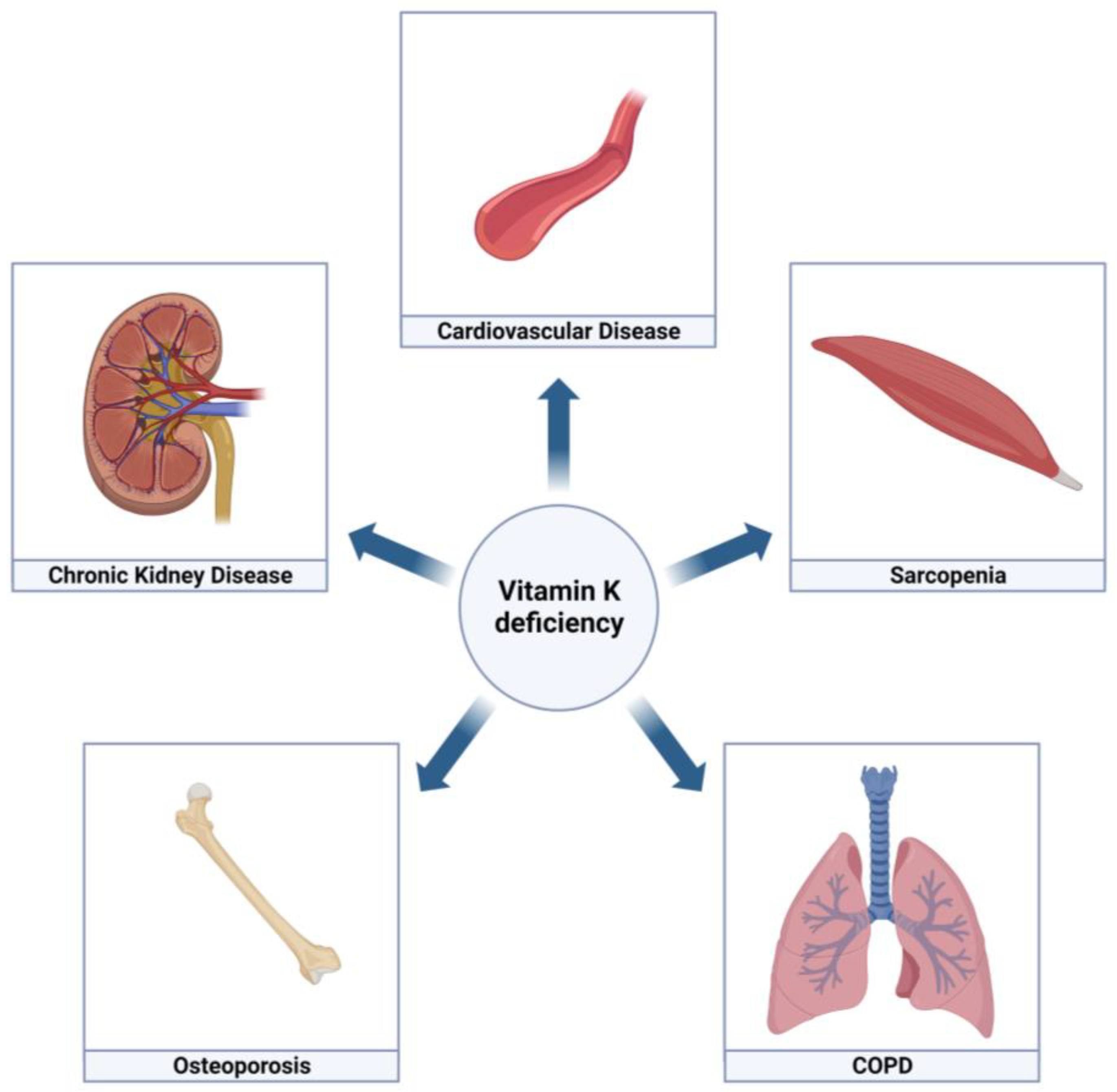 Vitamin K Deficiency