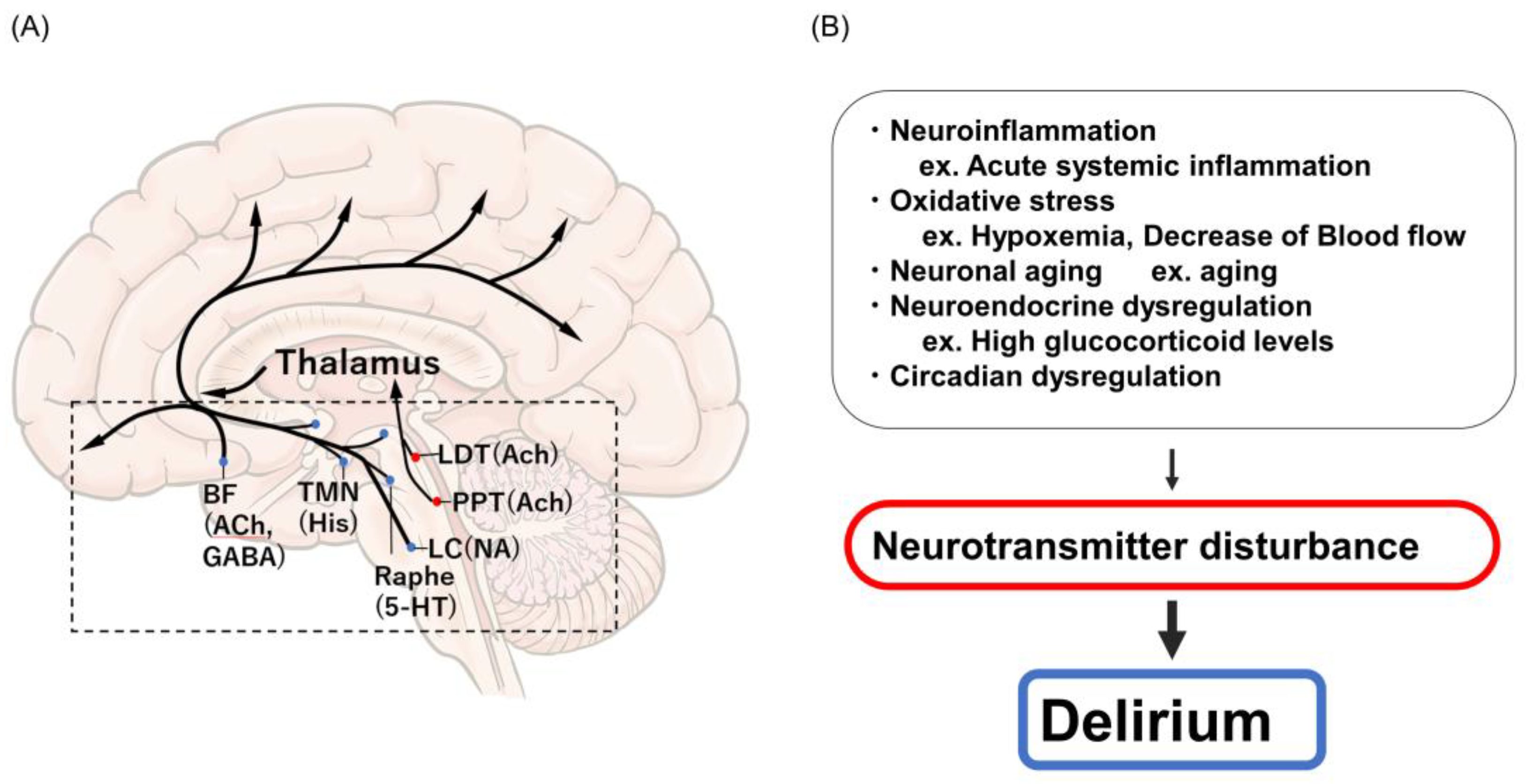JCM | Free Full-Text | Sepsis-Associated Delirium: A Narrative Review