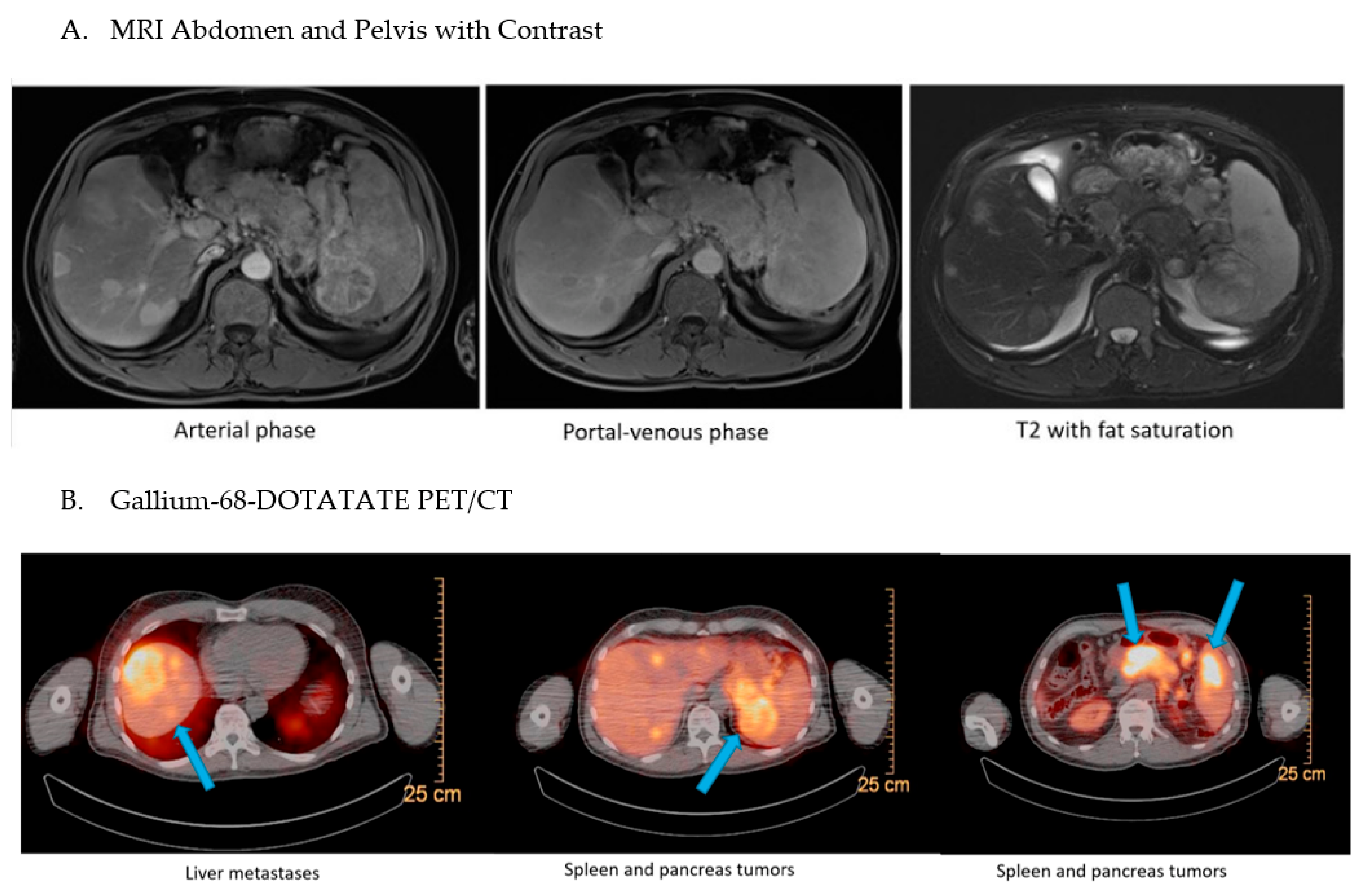 Jcm 12 01280 g001 550
