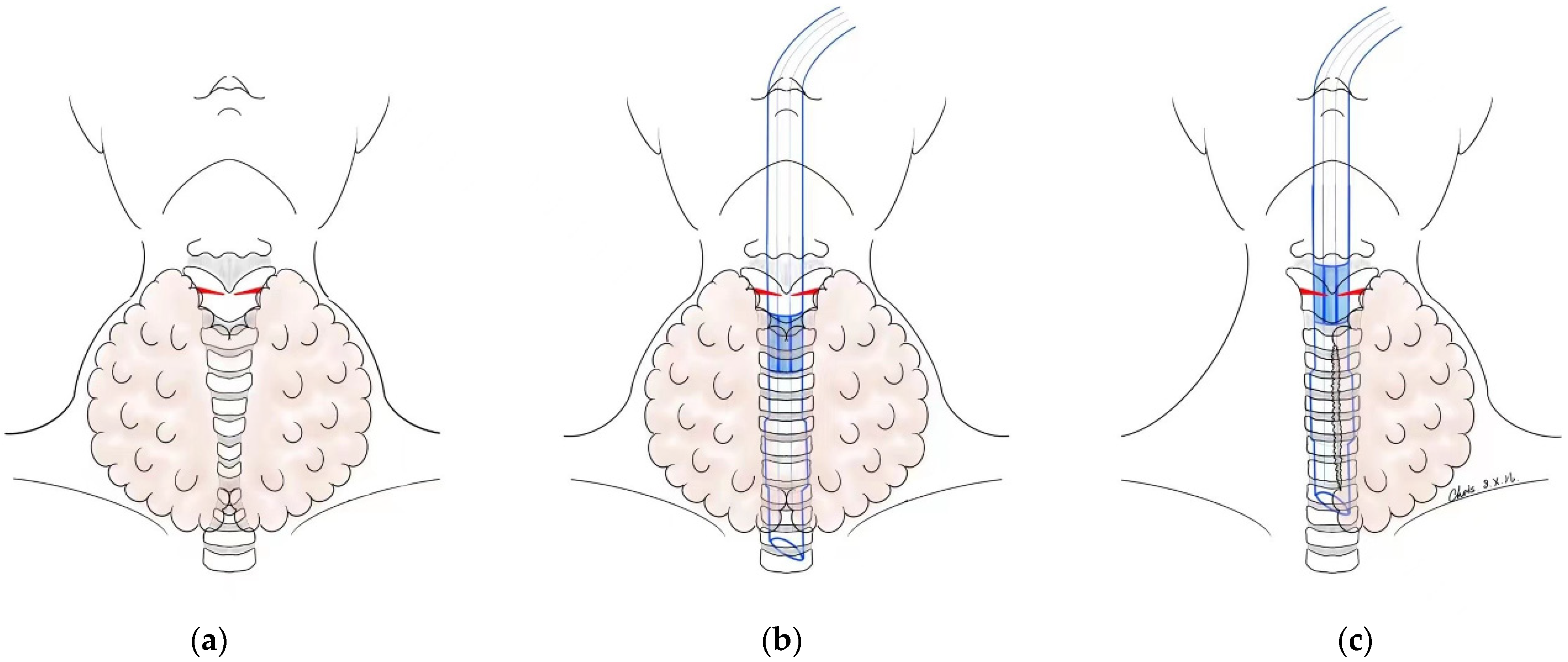 Jcm 12 01308 g002 550