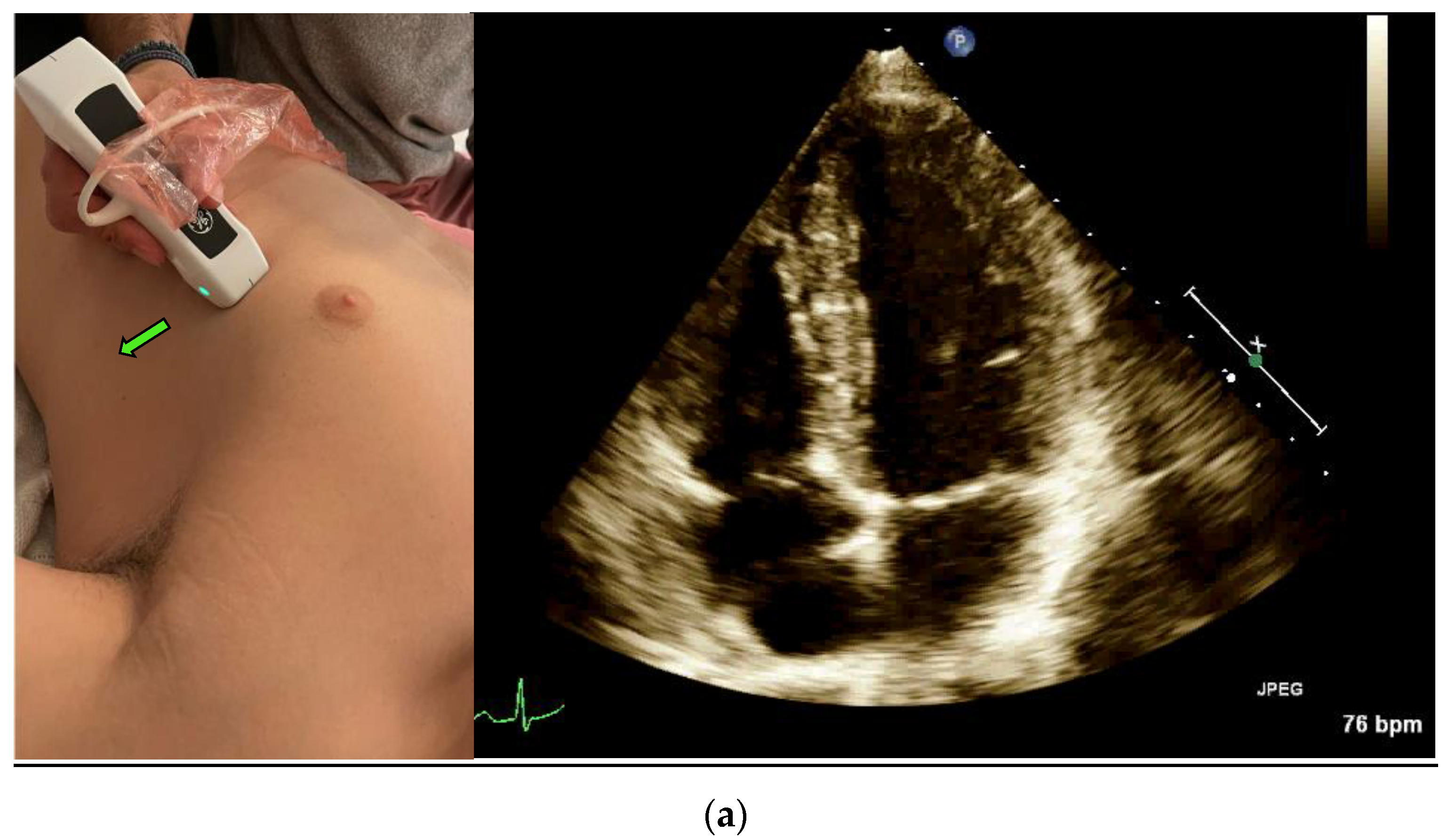 Jcm 12 01352 g001a 550