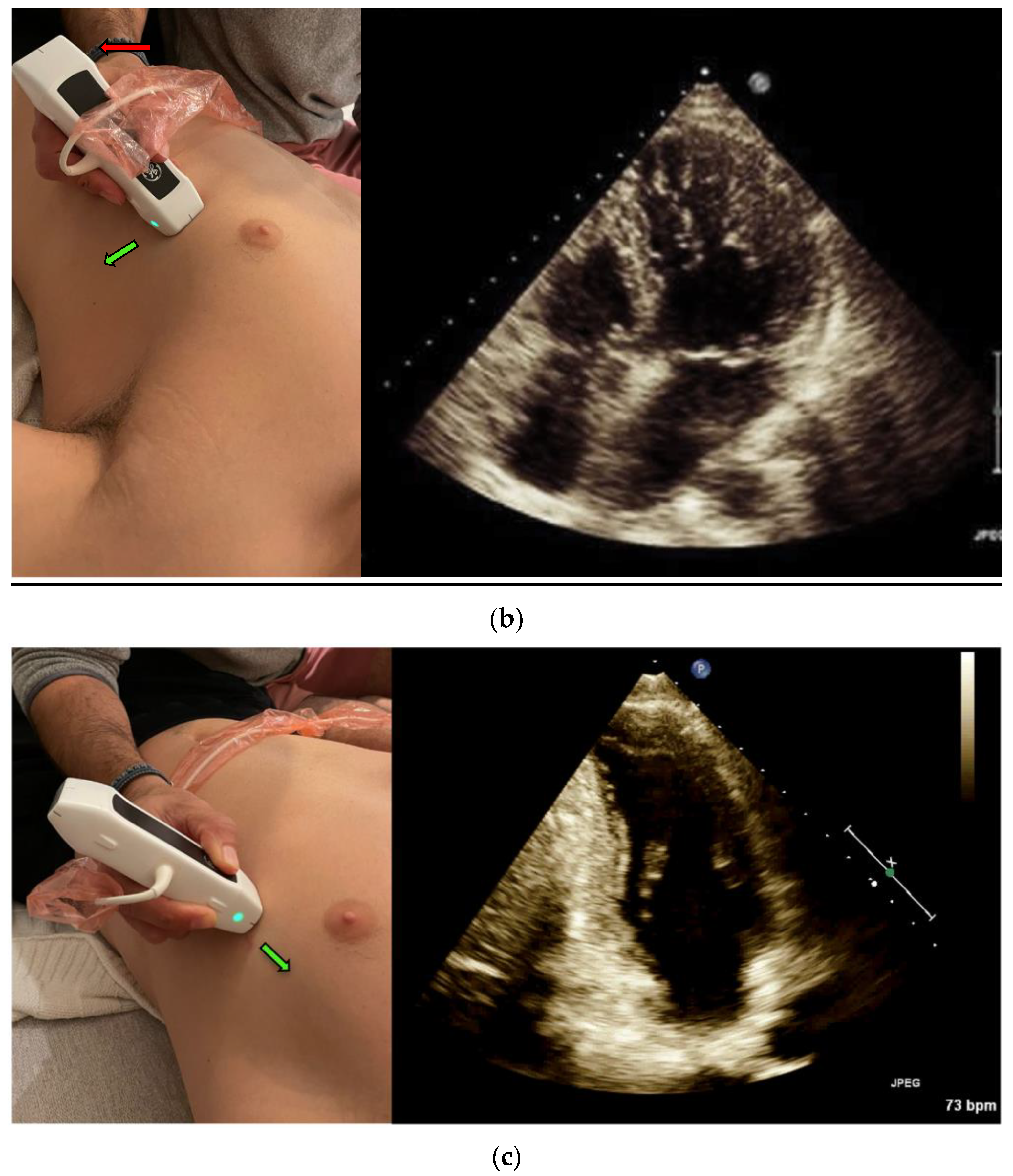 Jcm 12 01352 g001b 550