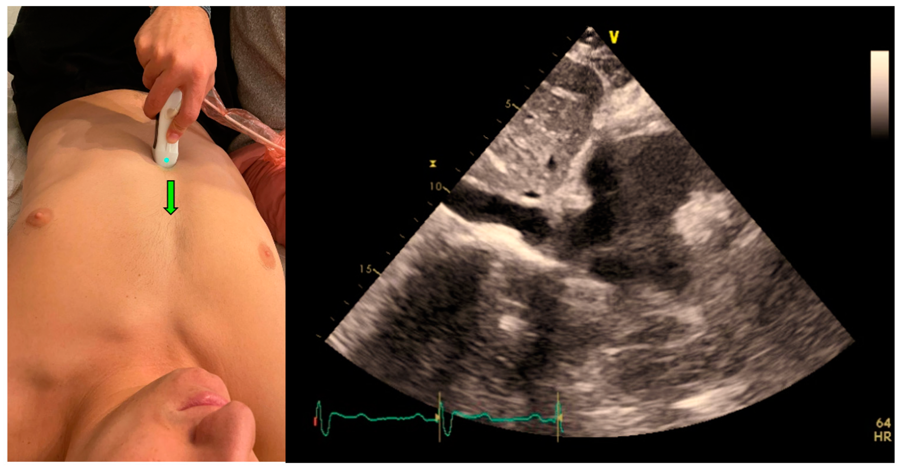 Jcm 12 01352 g003 550