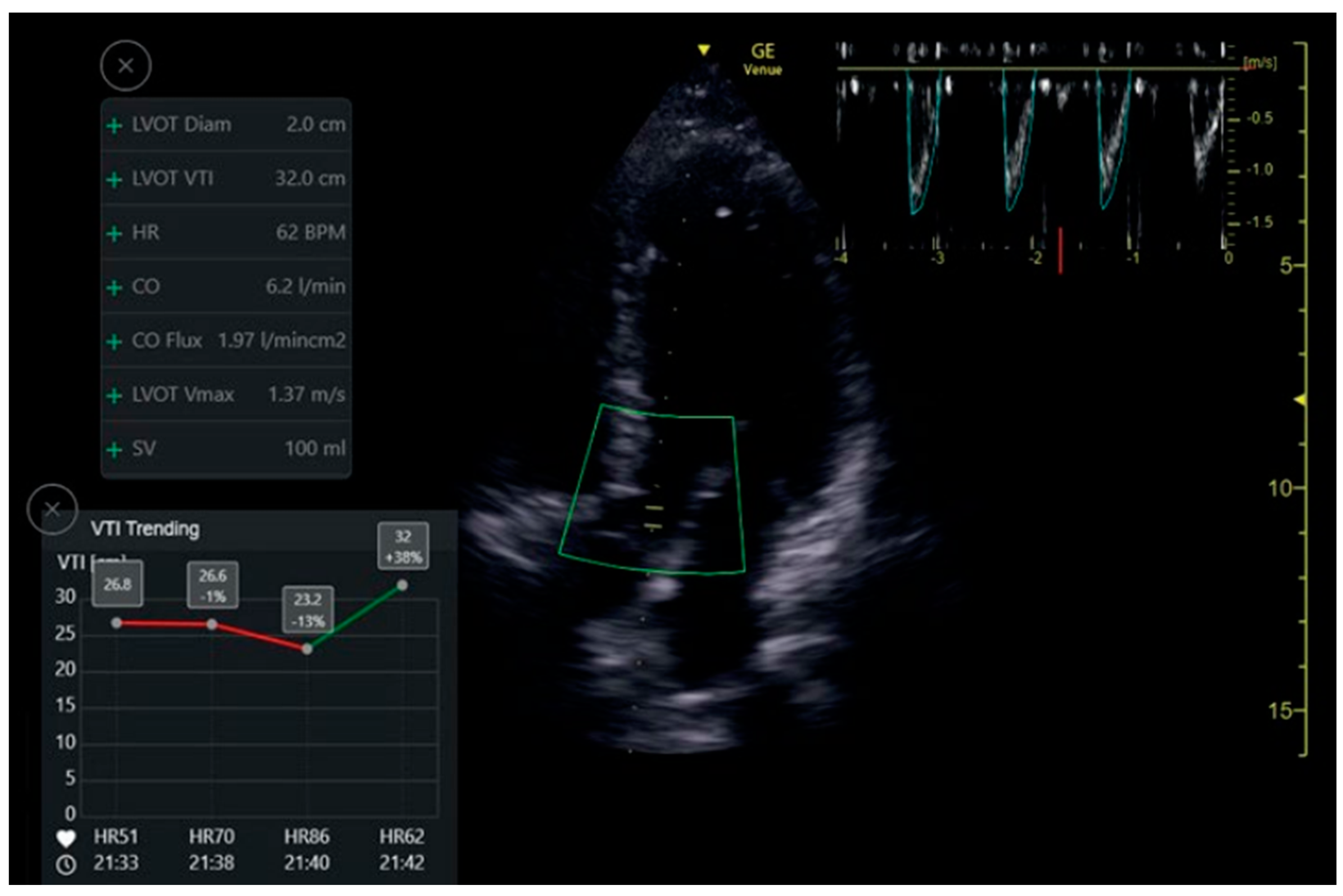 Jcm 12 01352 g005 550