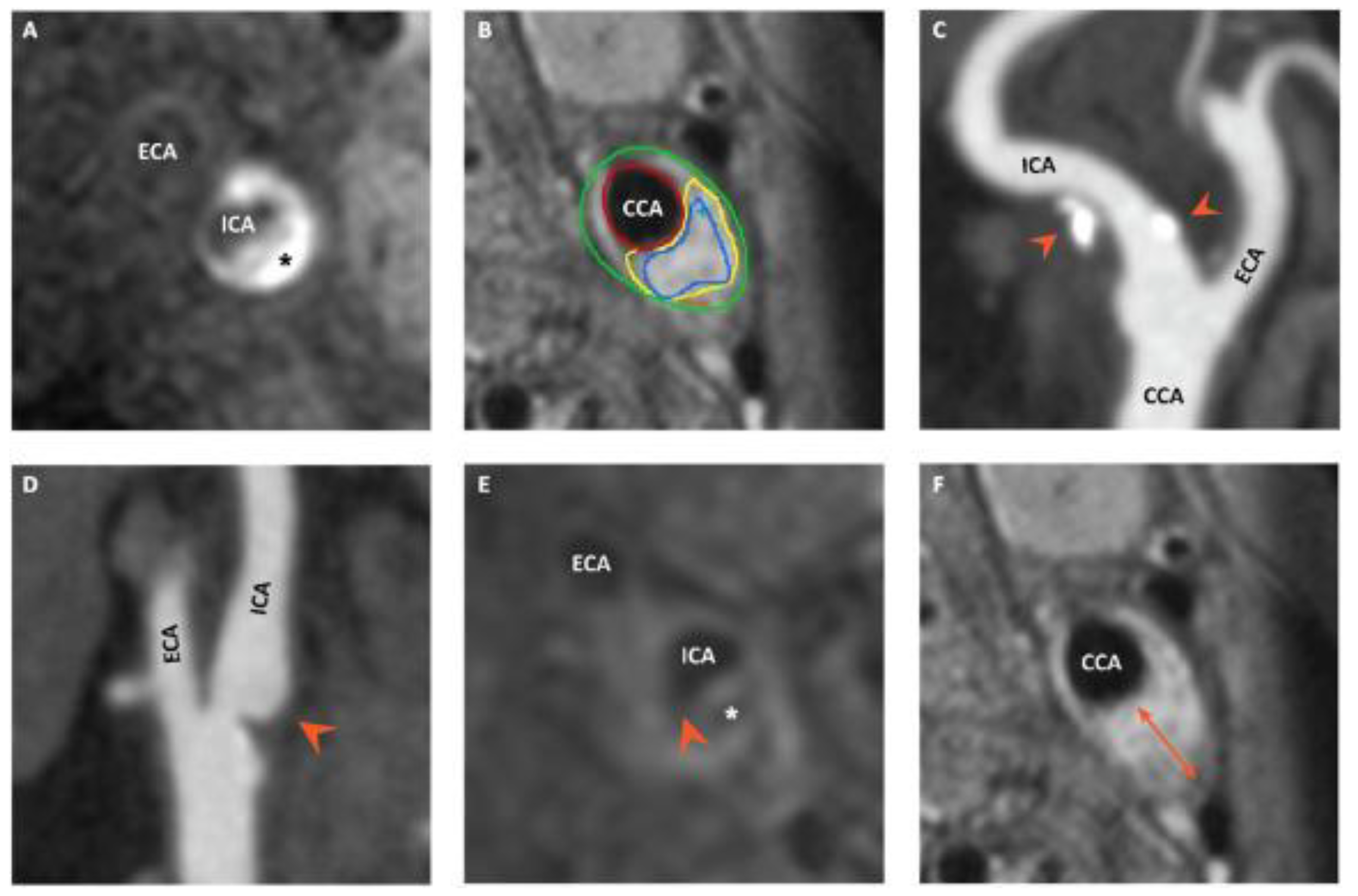 Jcm 12 01370 g001 Jcm 12 01370 g001