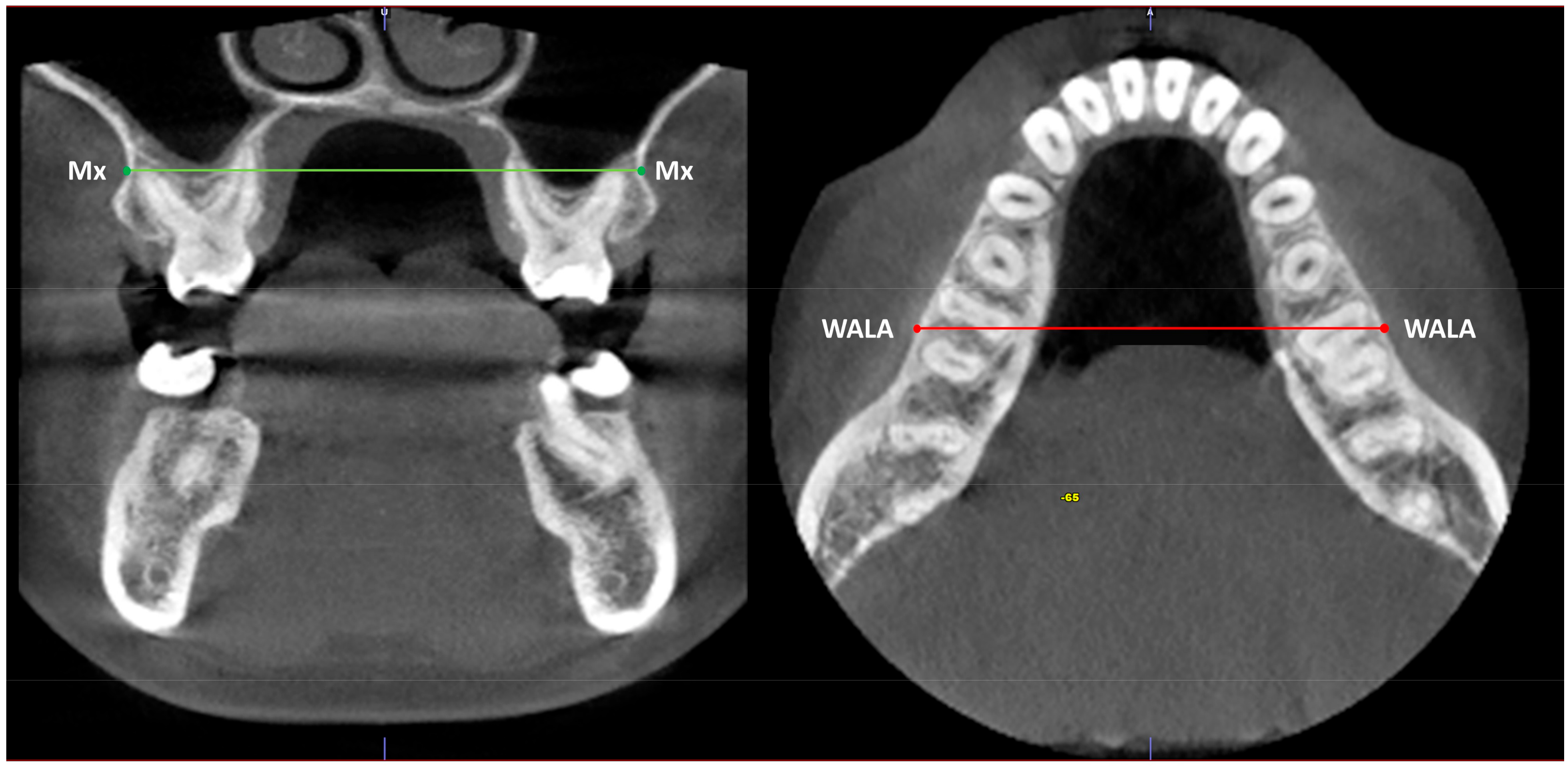 Jcm 12 01383 g001 Jcm 12 01383 g001