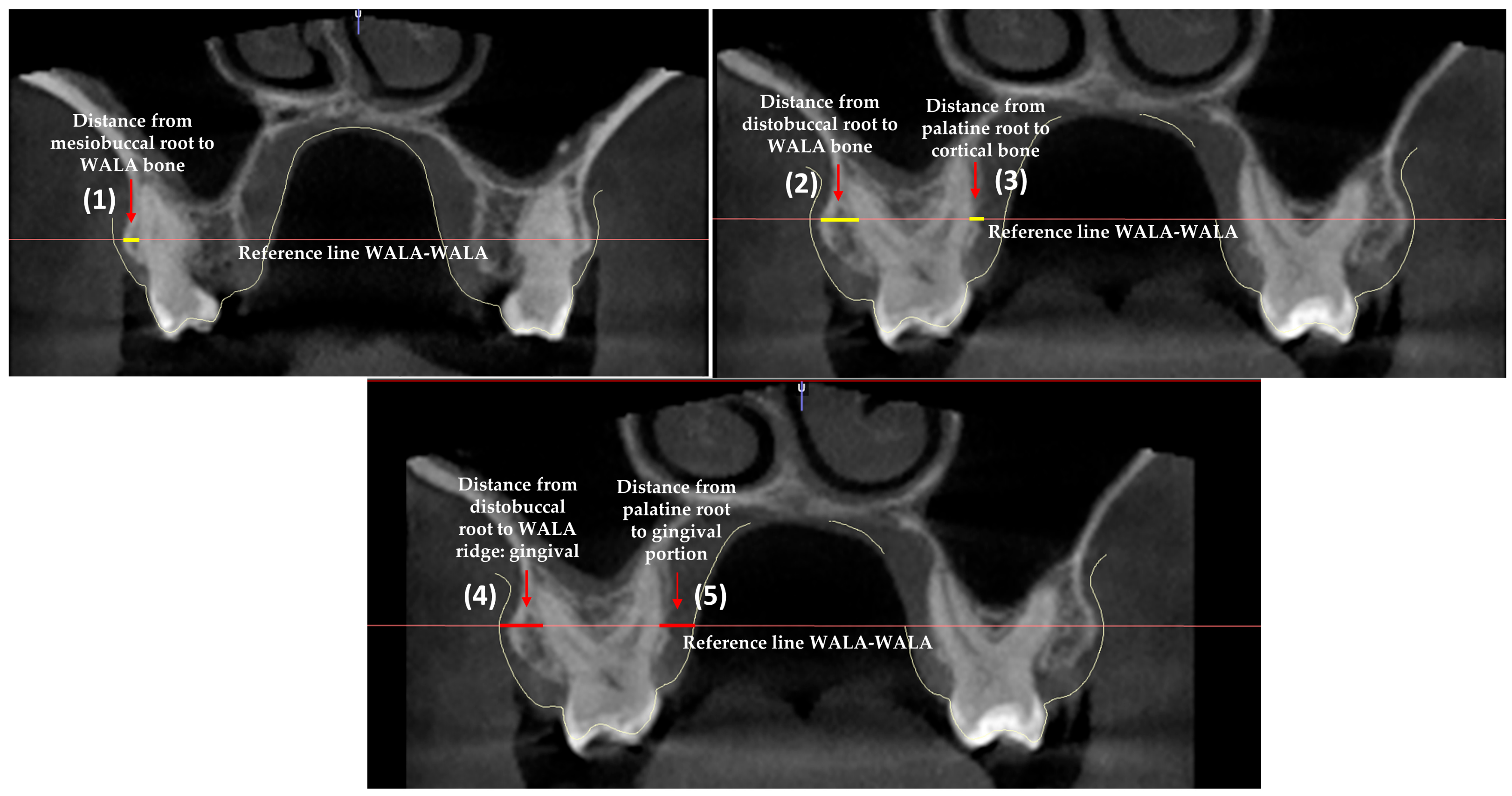 Jcm 12 01383 g004 Jcm 12 01383 g004