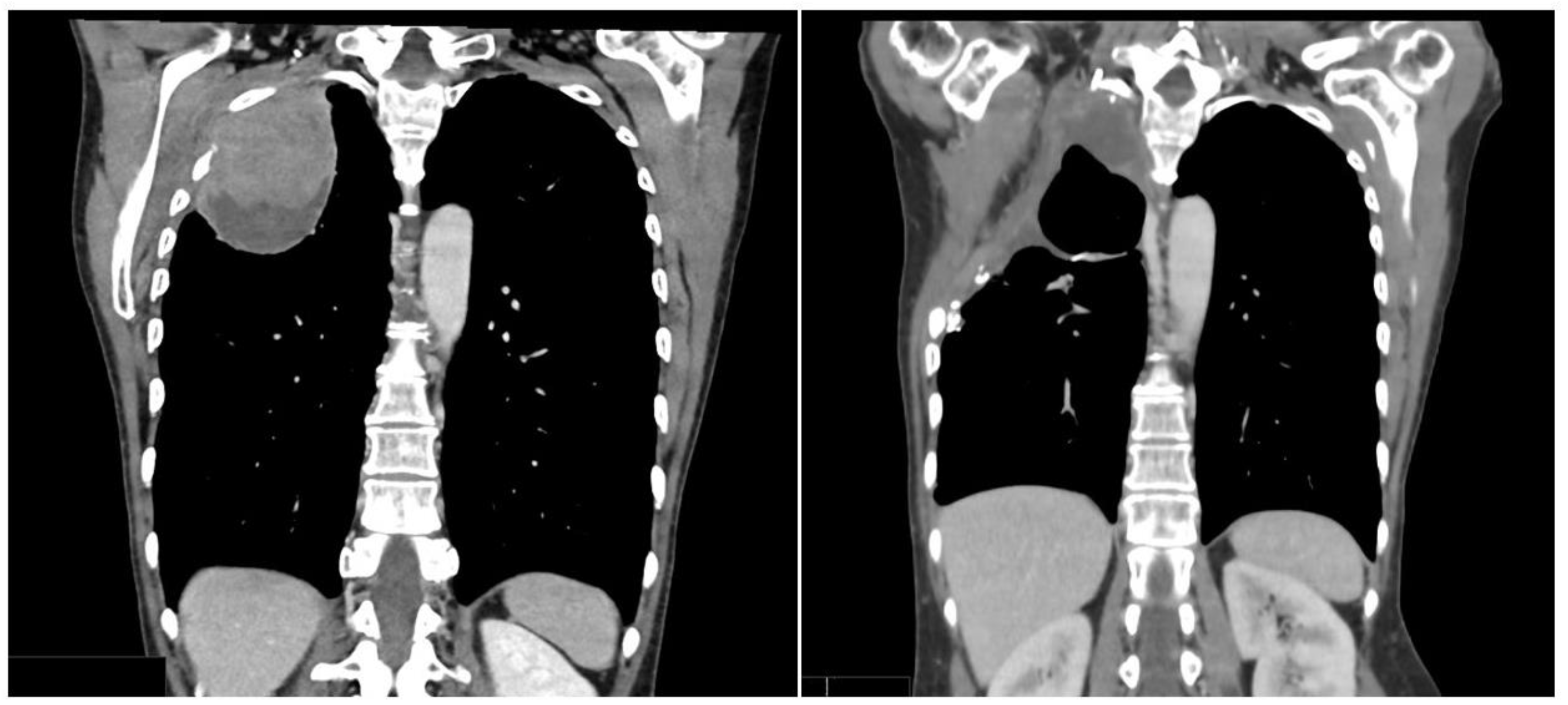 Jcm 12 01411 g003 Jcm 12 01411 g003