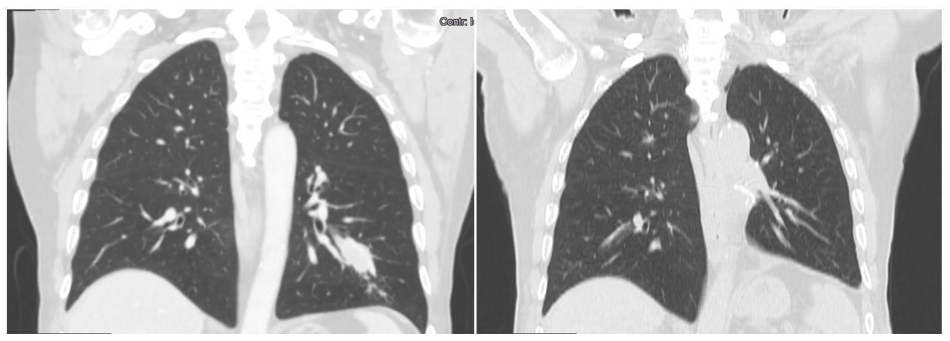 Jcm 12 01411 g005 Jcm 12 01411 g005