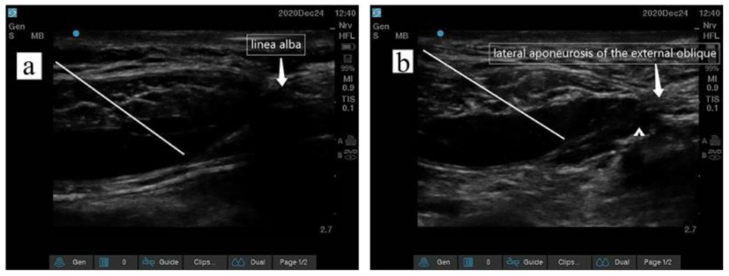 Jcm 12 01414 g003 Jcm 12 01414 g003
