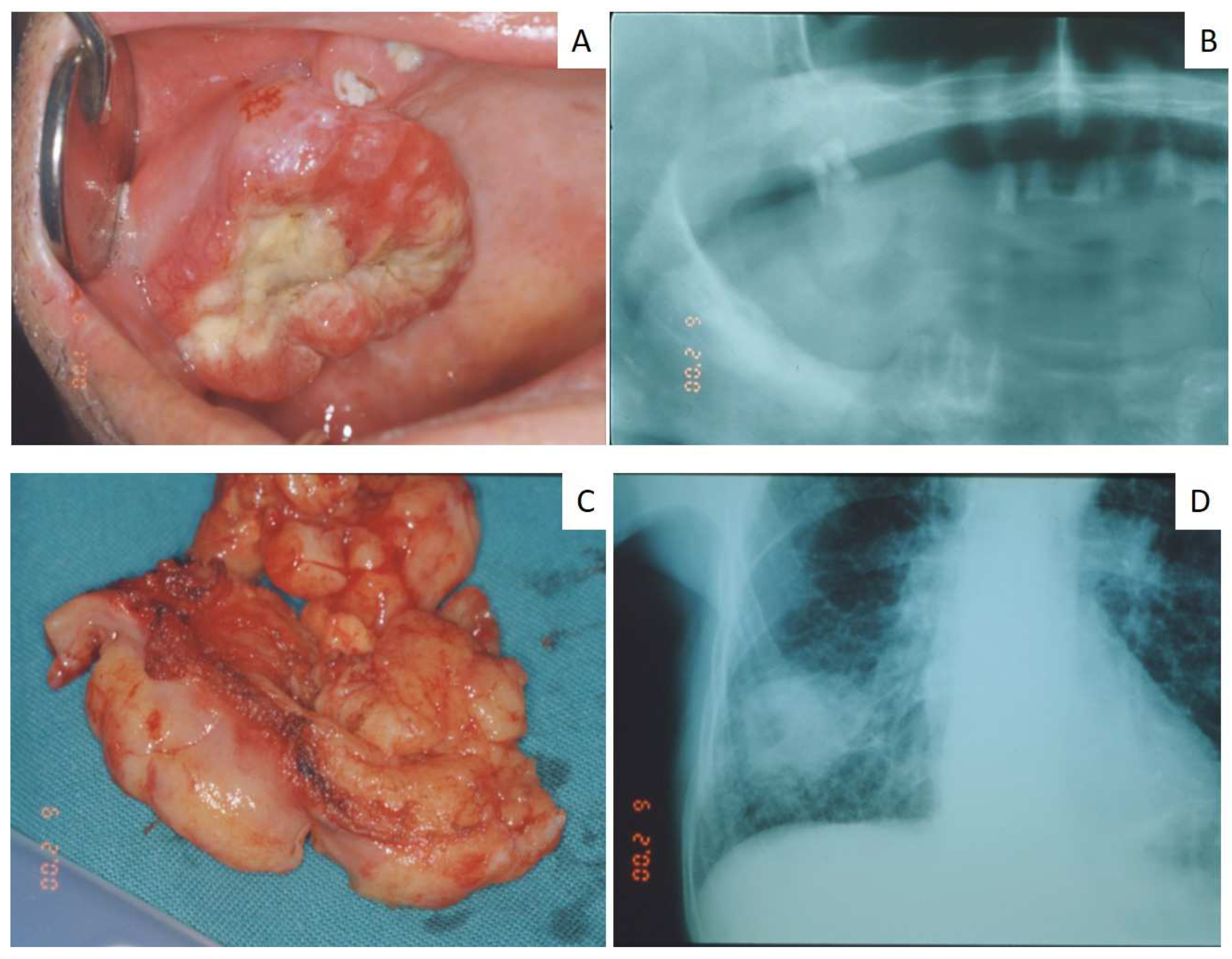 Jcm 12 01429 g002 Jcm 12 01429 g002