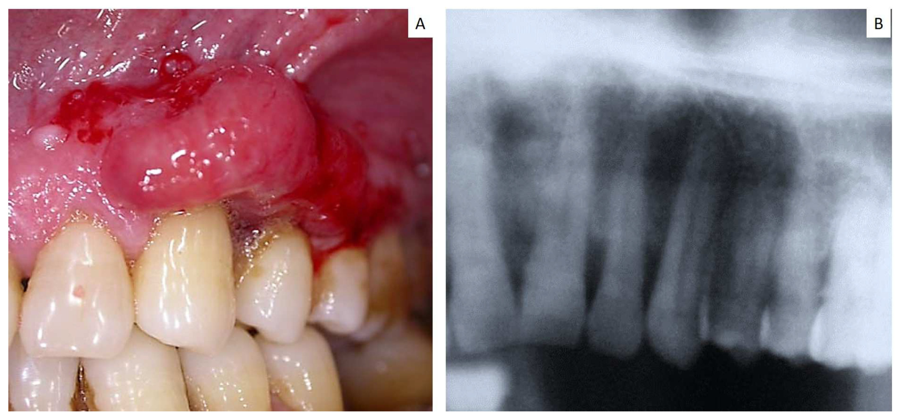 Jcm 12 01429 g003 Jcm 12 01429 g003