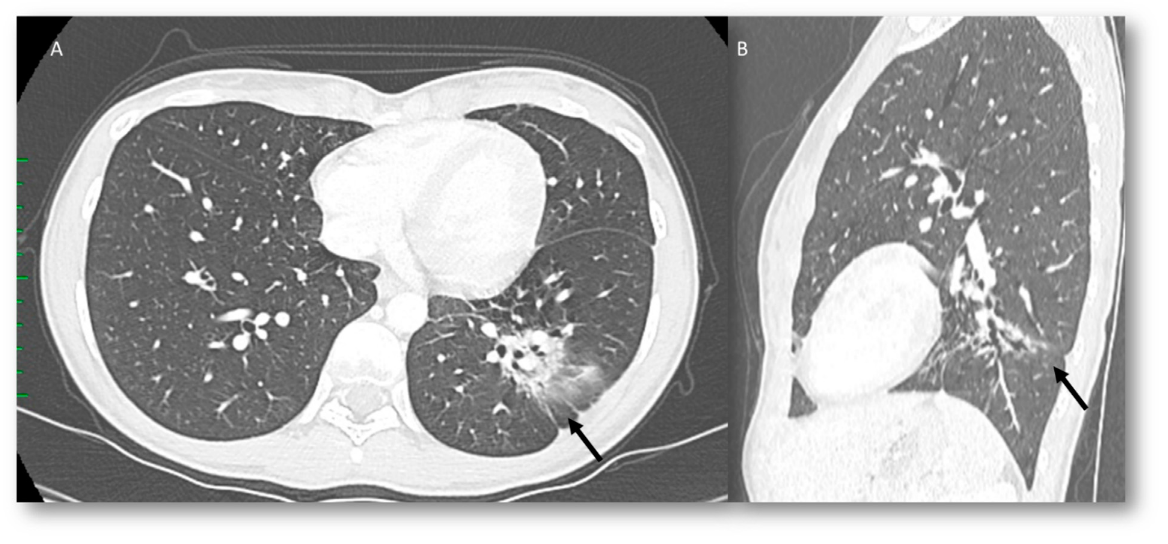 Jcm 12 01442 g002 Jcm 12 01442 g002