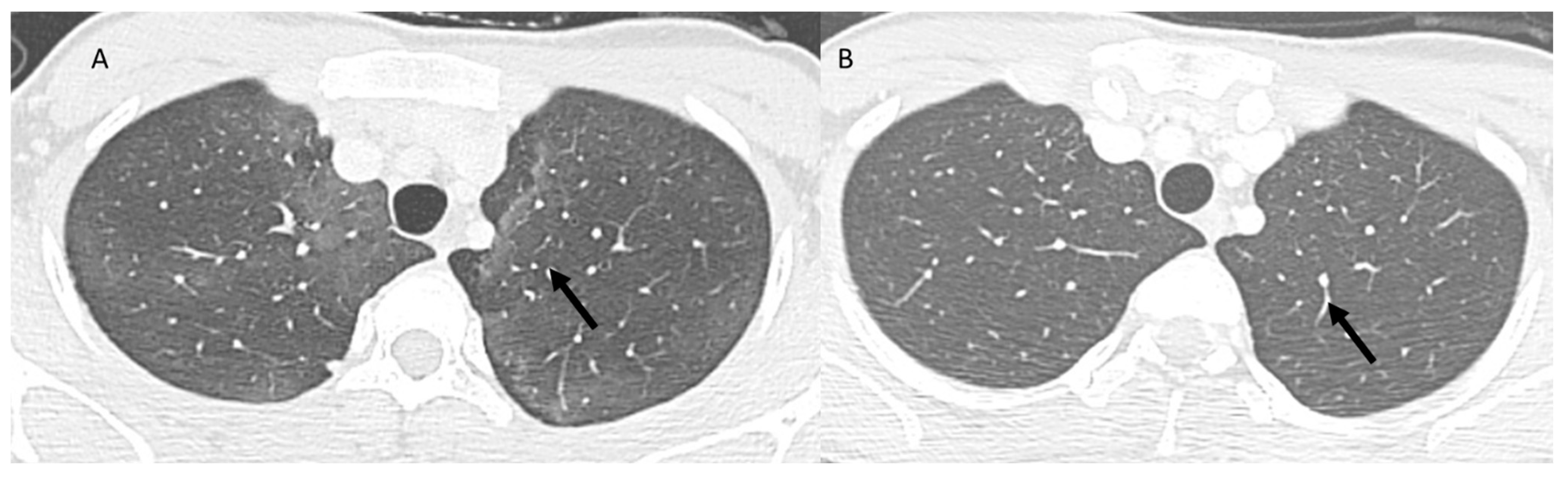 Jcm 12 01442 g004 Jcm 12 01442 g004