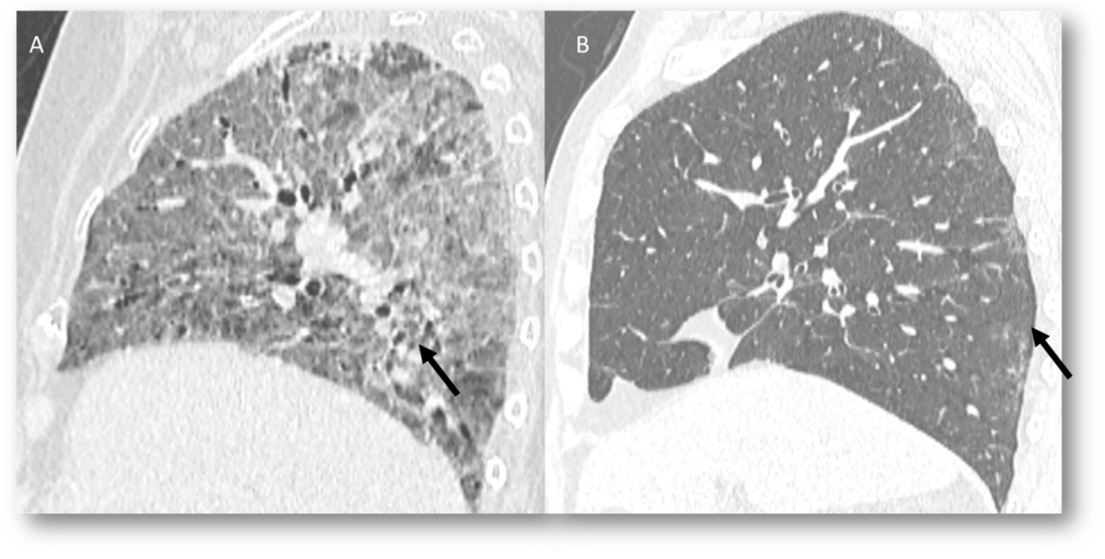 Jcm 12 01442 g005 Jcm 12 01442 g005