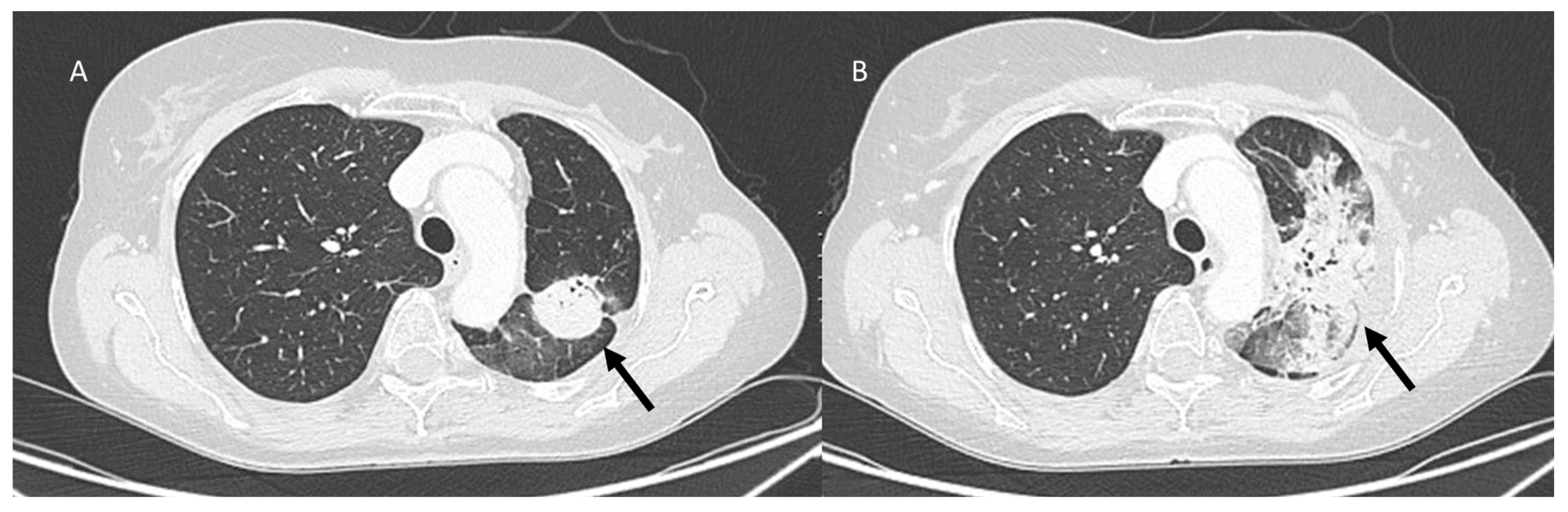 Jcm 12 01442 g006 Jcm 12 01442 g006