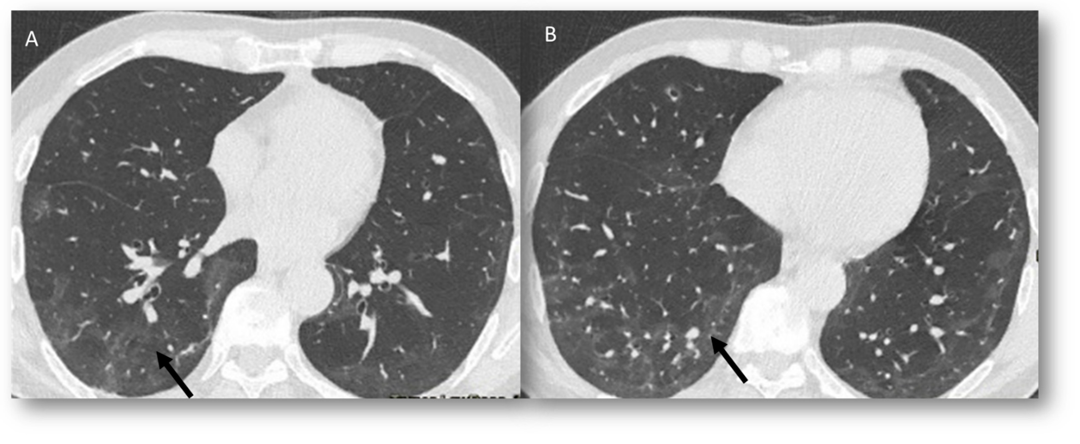 Jcm 12 01442 g007 Jcm 12 01442 g007