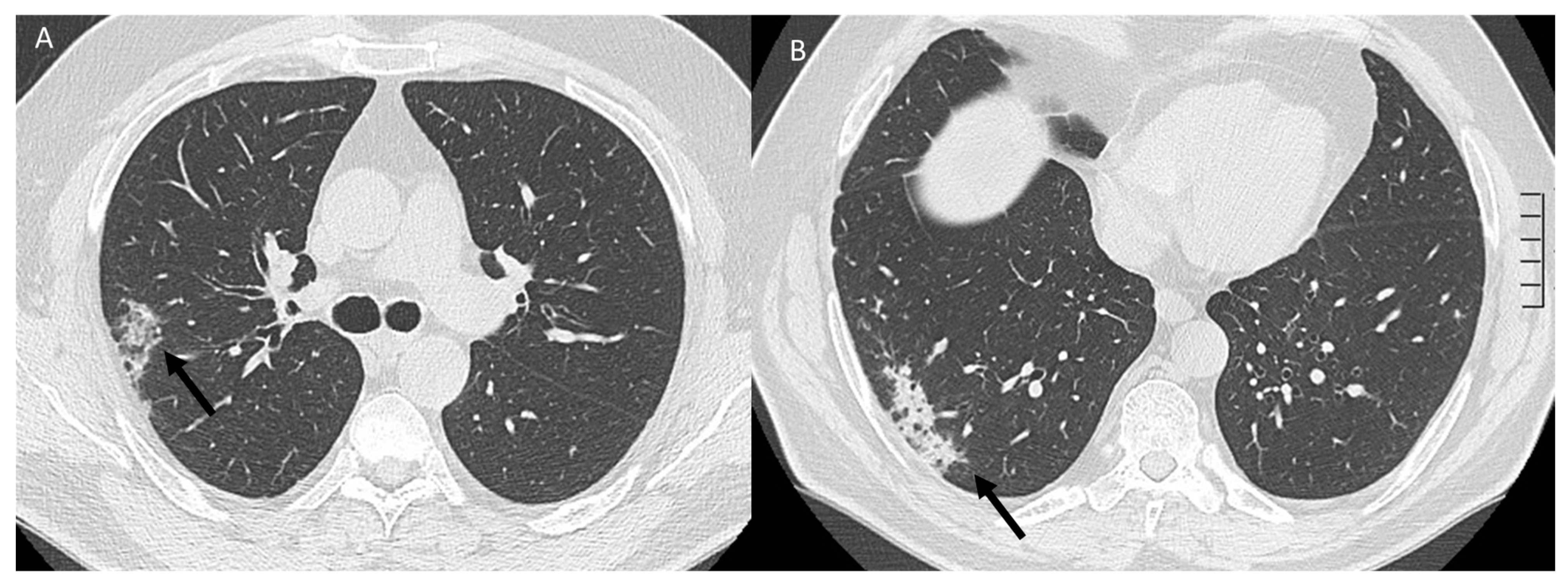 Jcm 12 01442 g008 Jcm 12 01442 g008