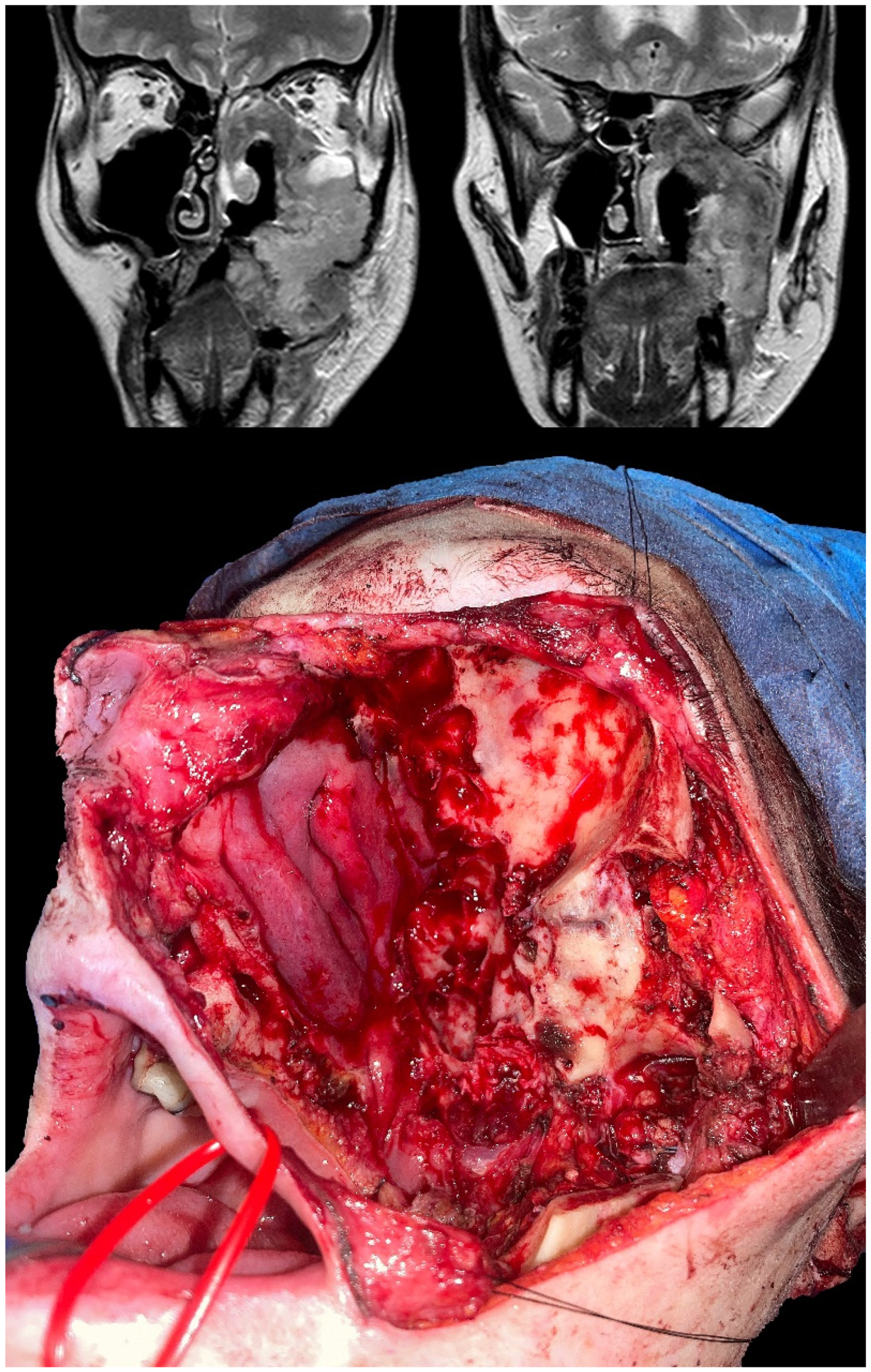 Jcm 12 01492 g002 550