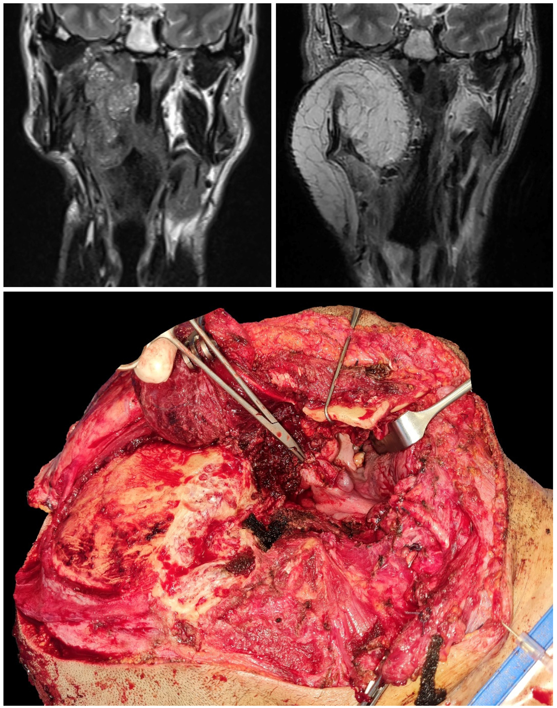 Jcm 12 01492 g003 550