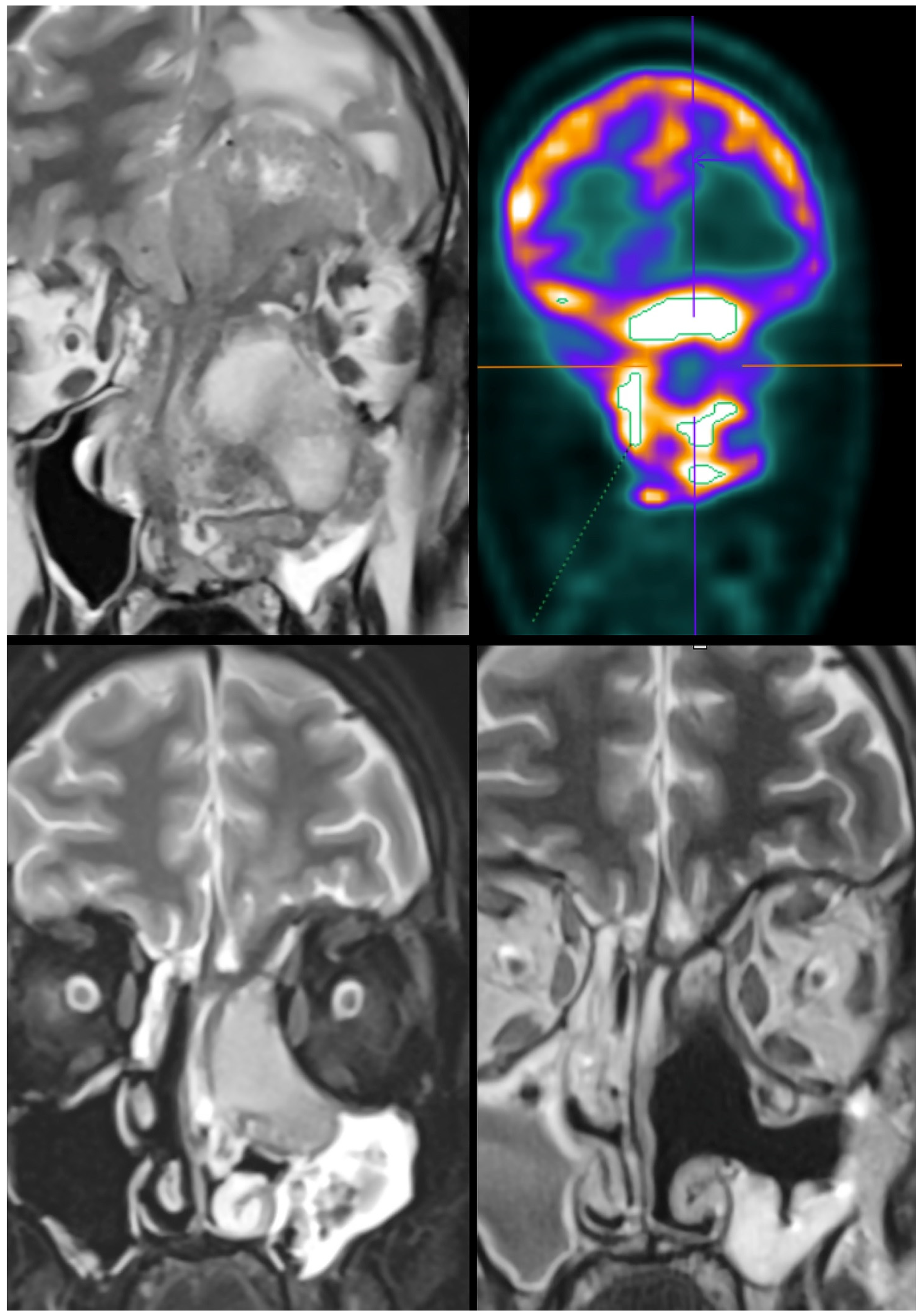 Jcm 12 01492 g005 550