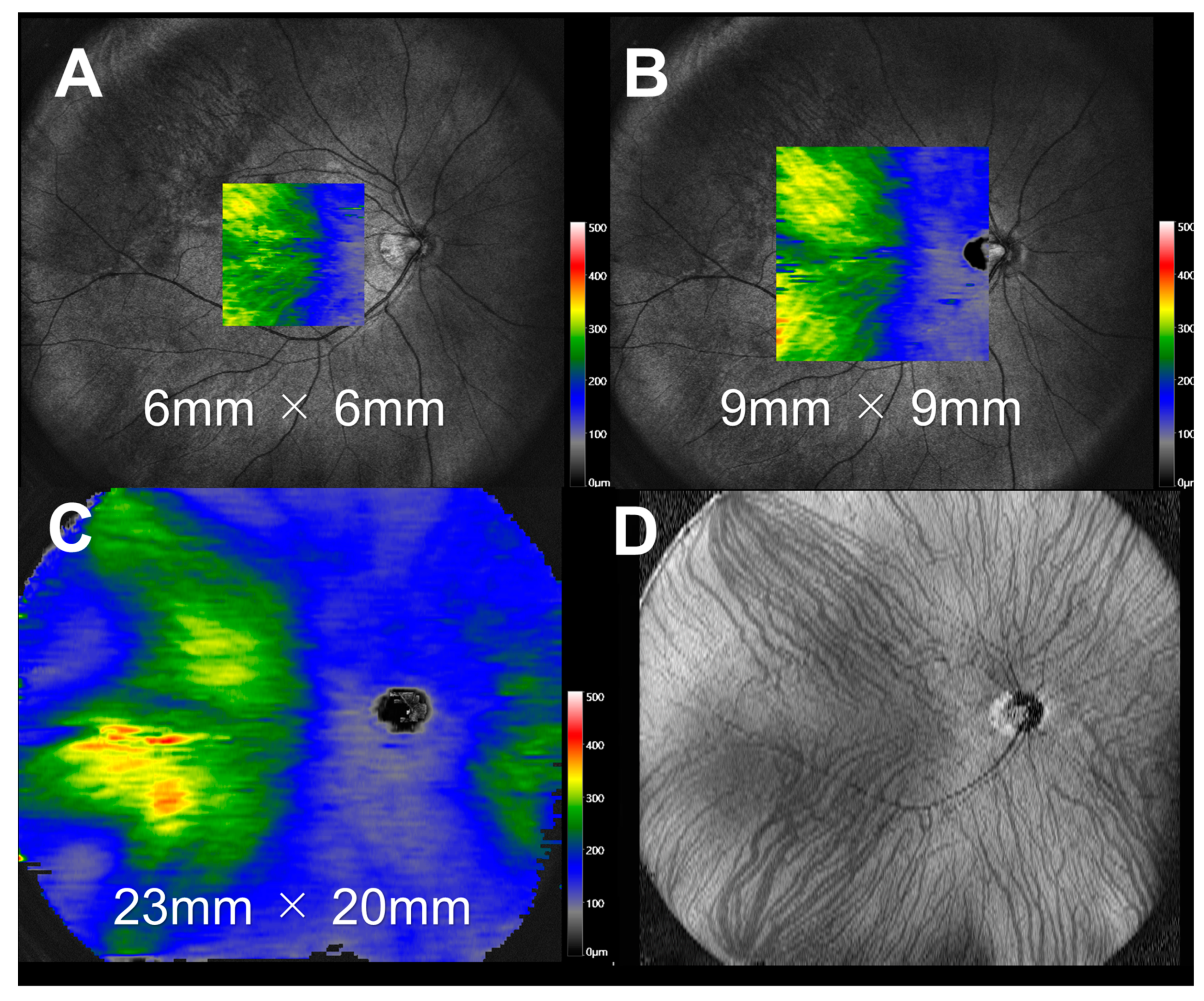 Jcm 12 01505 g001 Jcm 12 01505 g001