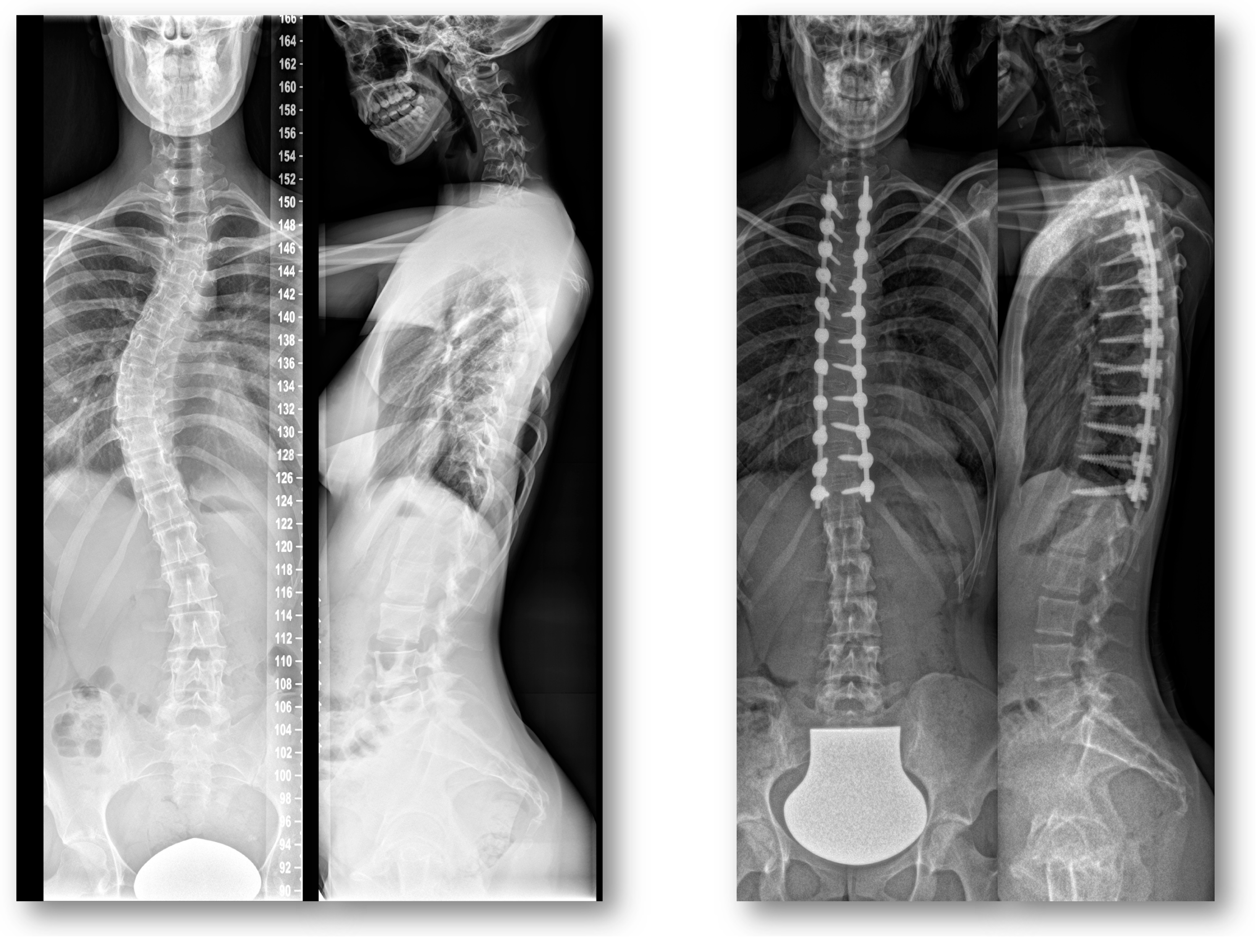 Jcm 12 01551 g003 Jcm 12 01551 g003