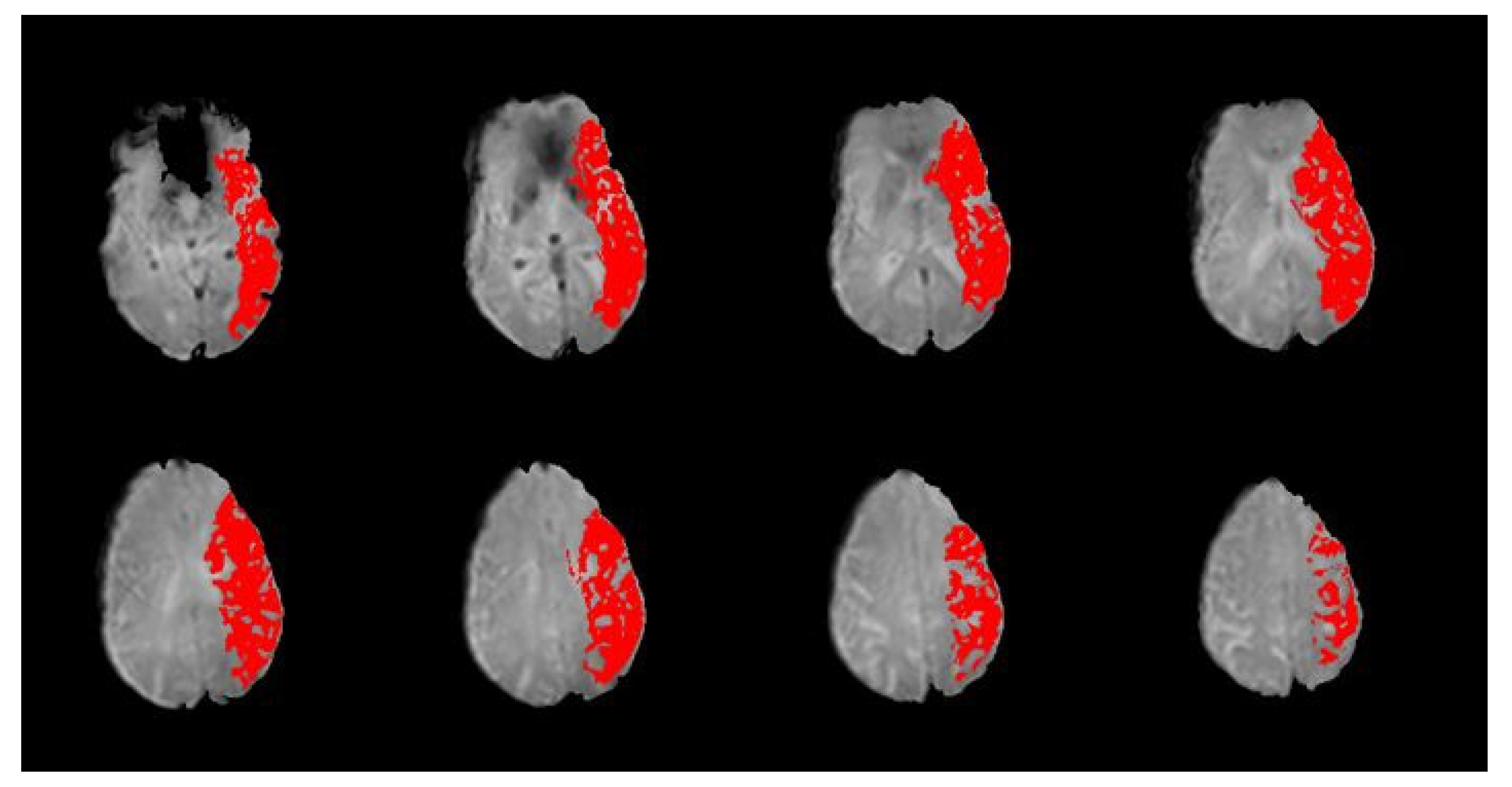 Jcm 12 01554 g002 Jcm 12 01554 g002