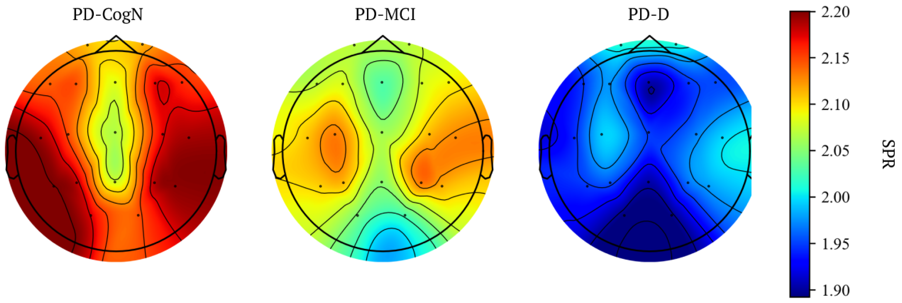 Jcm 12 01569 g007 Jcm 12 01569 g007