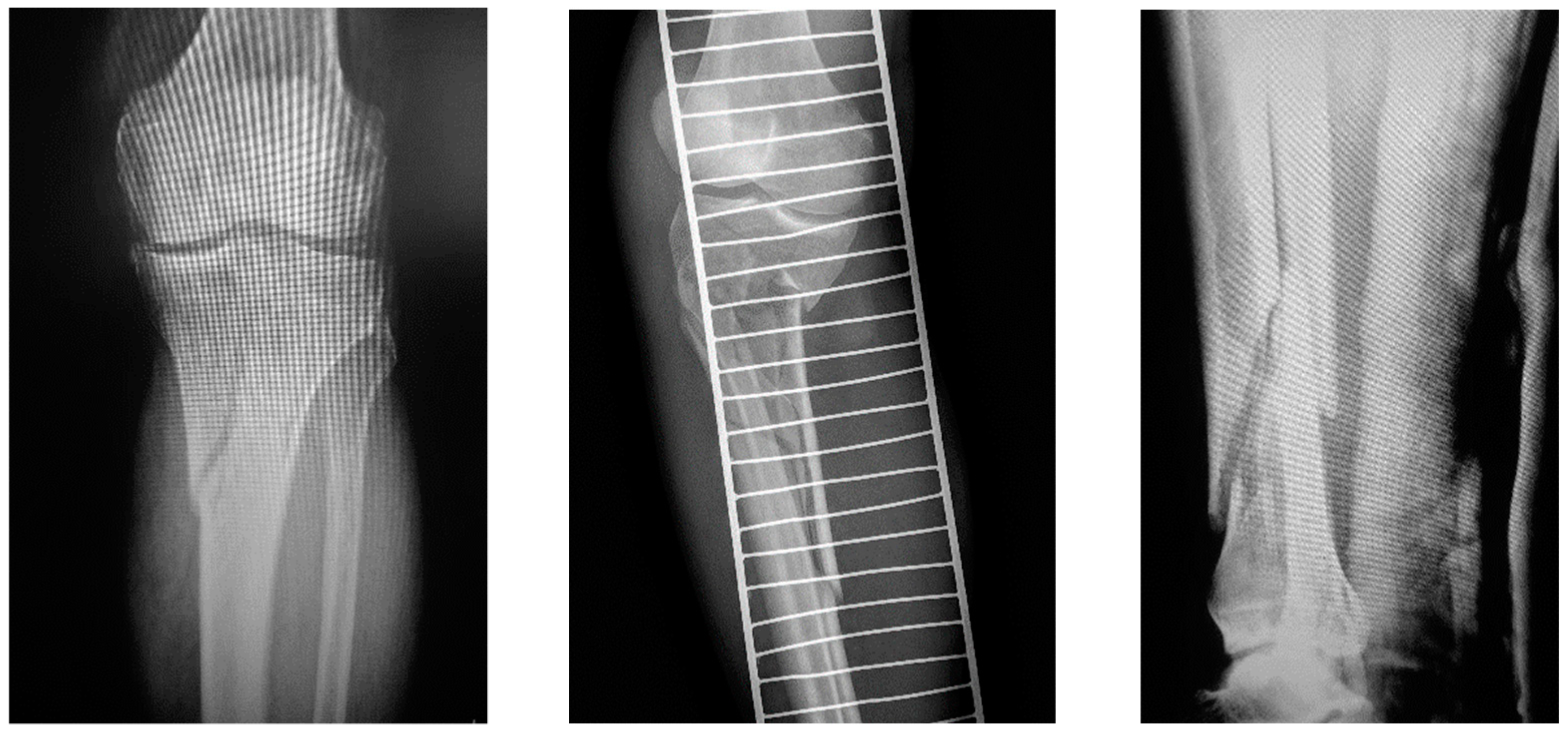 Jcm 12 01600 g001 Jcm 12 01600 g001