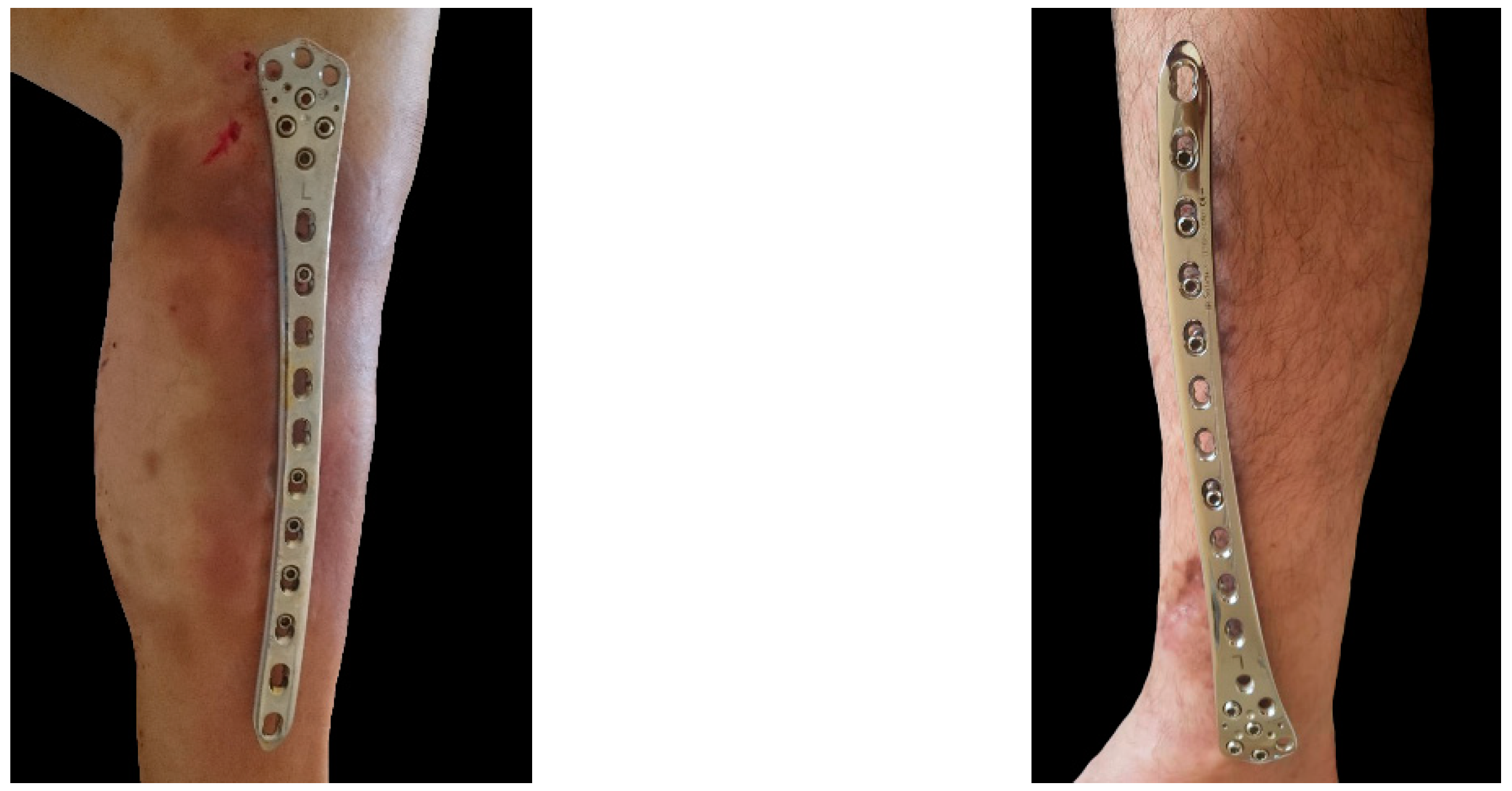 Jcm 12 01600 g003 Jcm 12 01600 g003