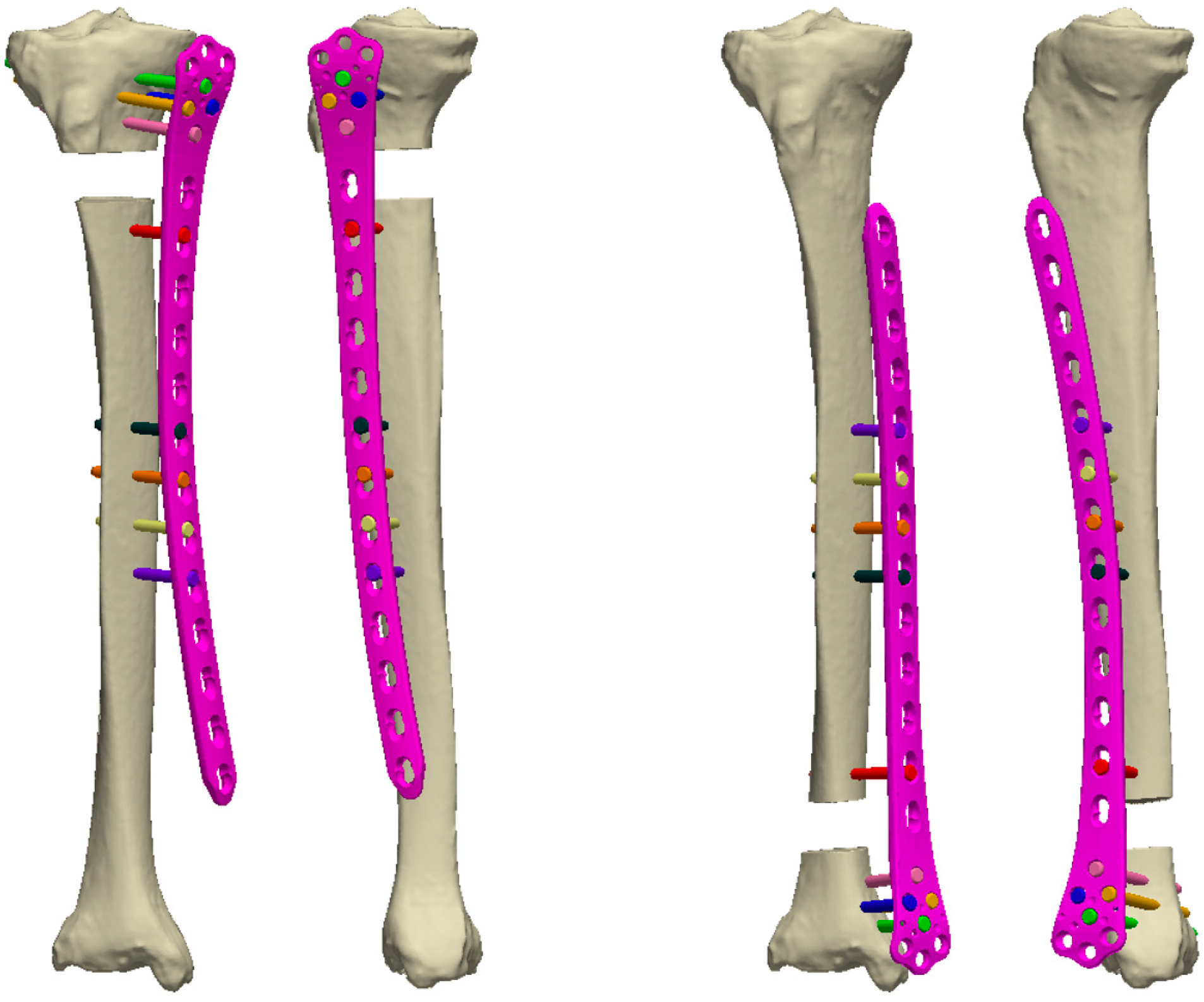 Jcm 12 01600 g005 Jcm 12 01600 g005