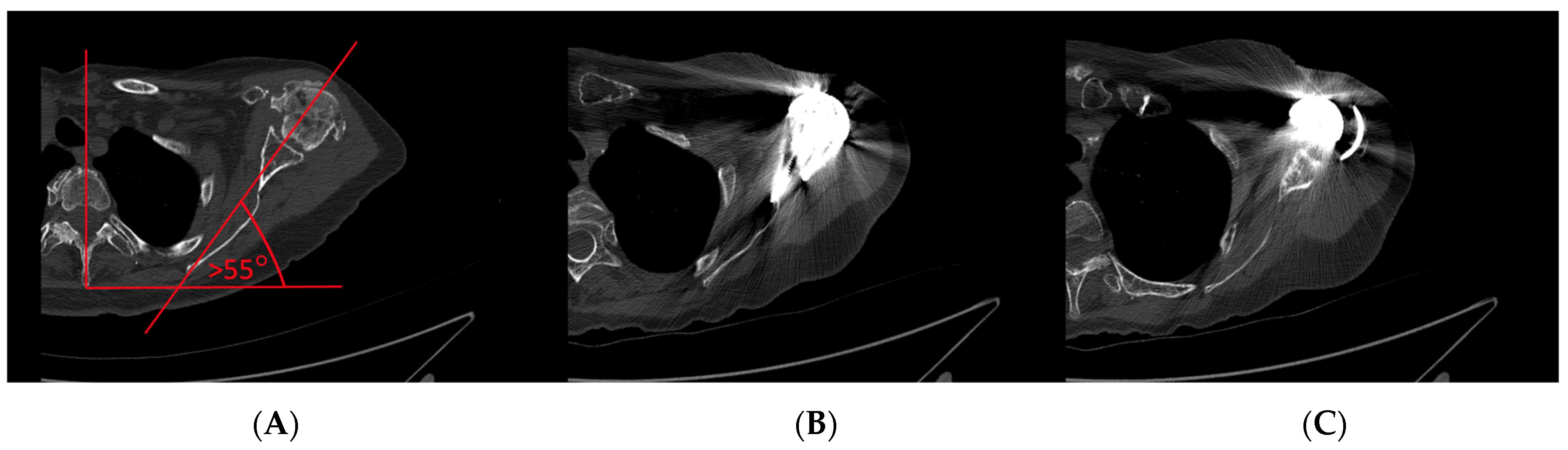 Jcm 12 01616 g003 Jcm 12 01616 g003