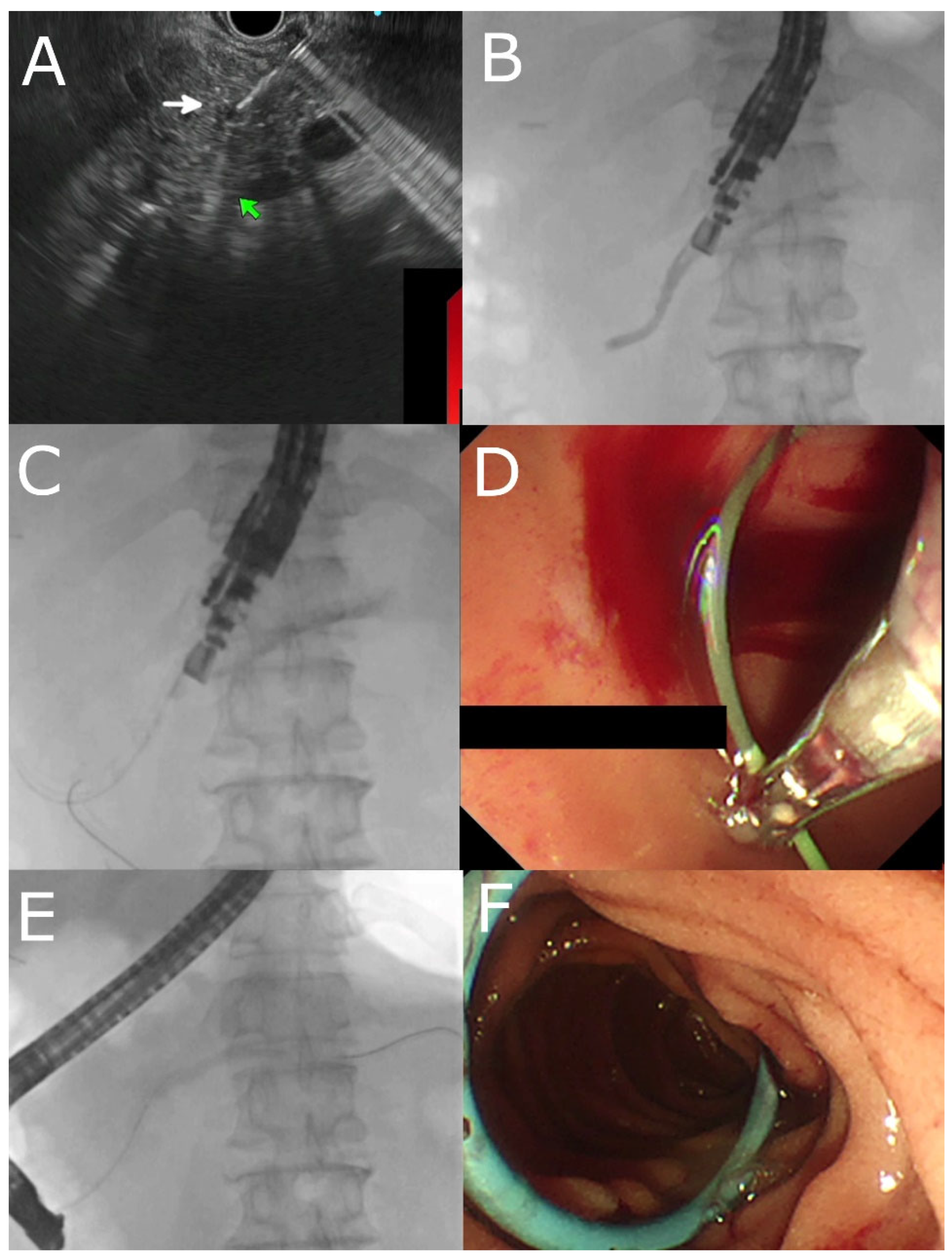 Jcm 12 01626 g001 Jcm 12 01626 g001