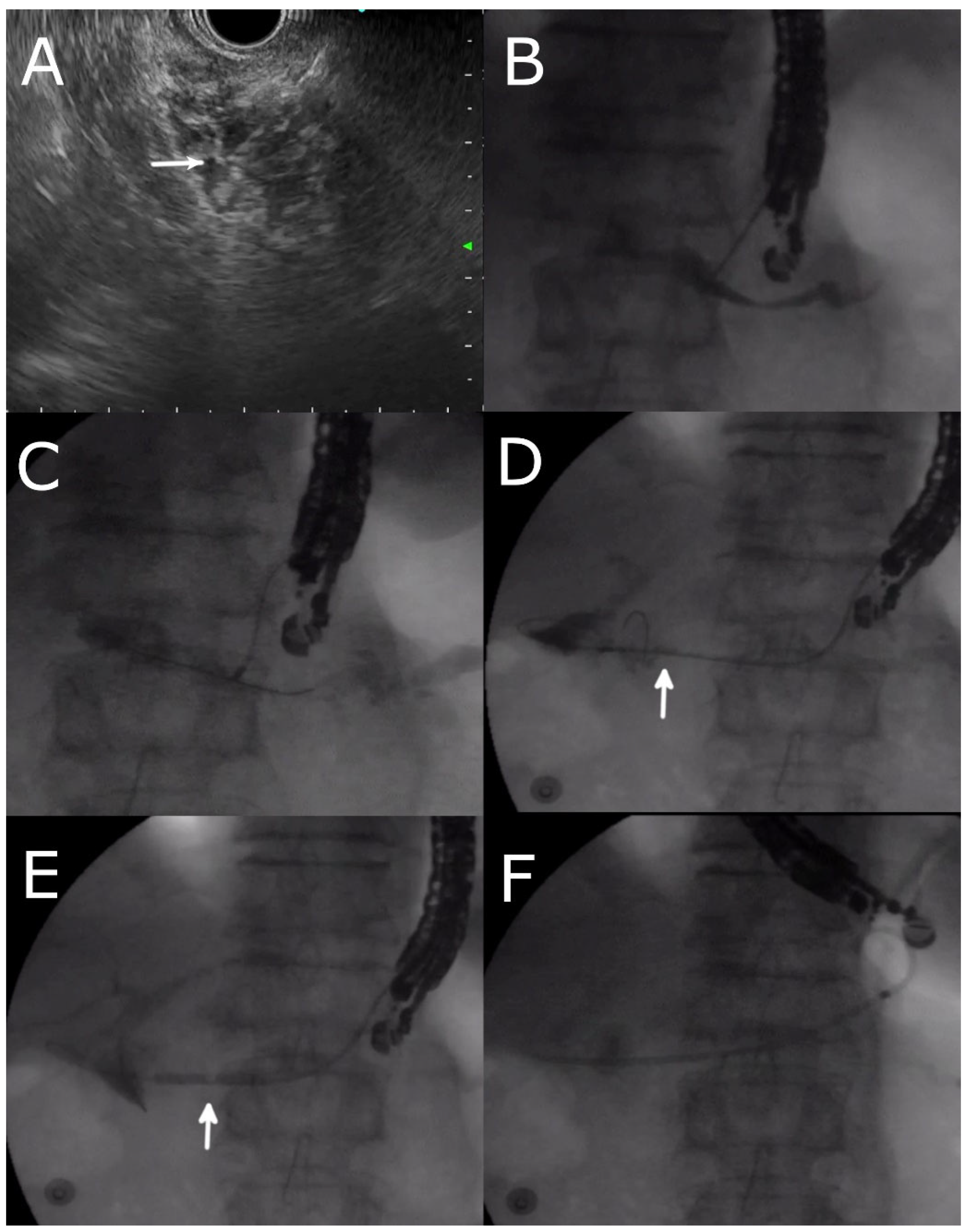 Jcm 12 01626 g002 Jcm 12 01626 g002