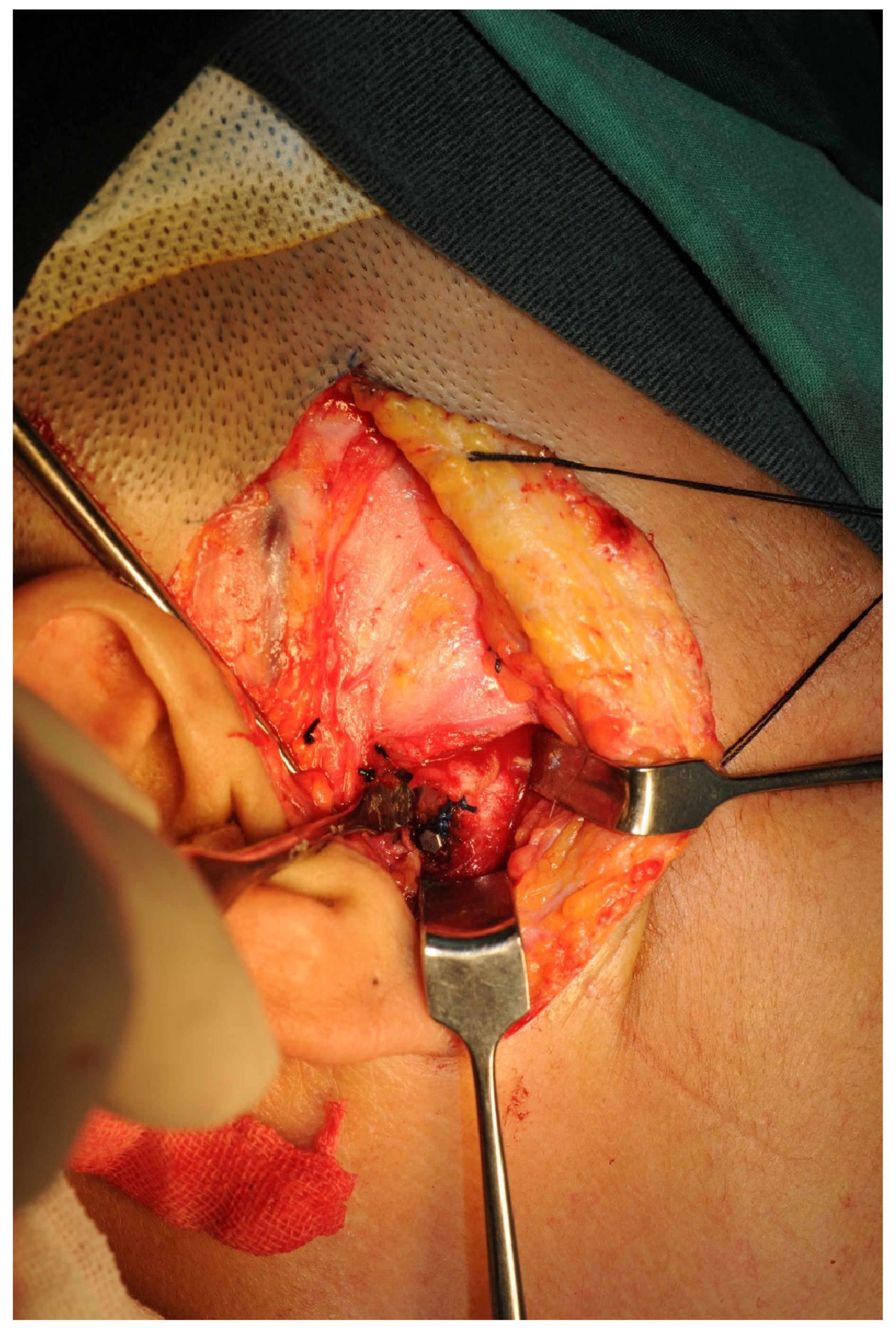 Jcm 12 01657 g002 Jcm 12 01657 g002