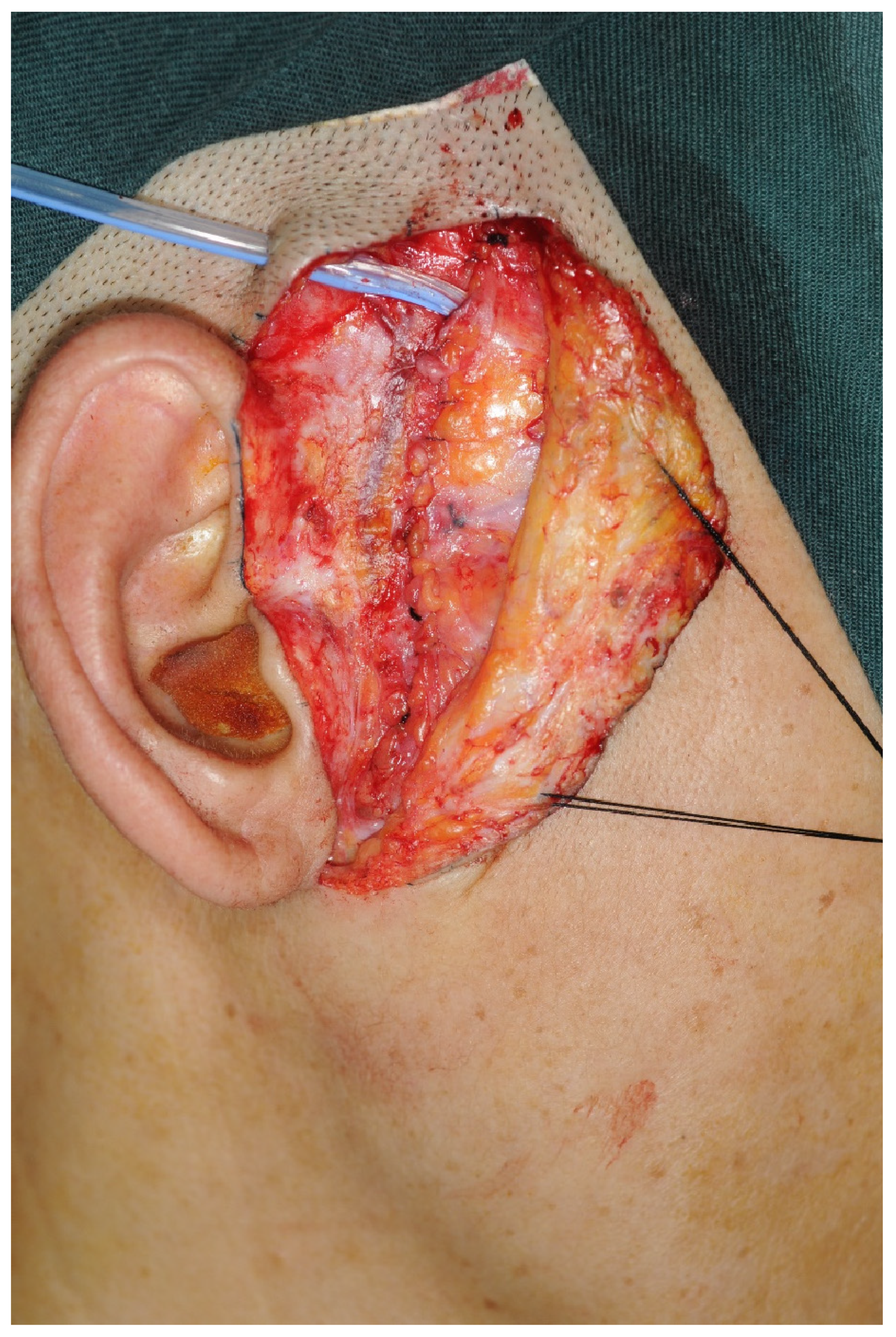 Jcm 12 01657 g003 Jcm 12 01657 g003