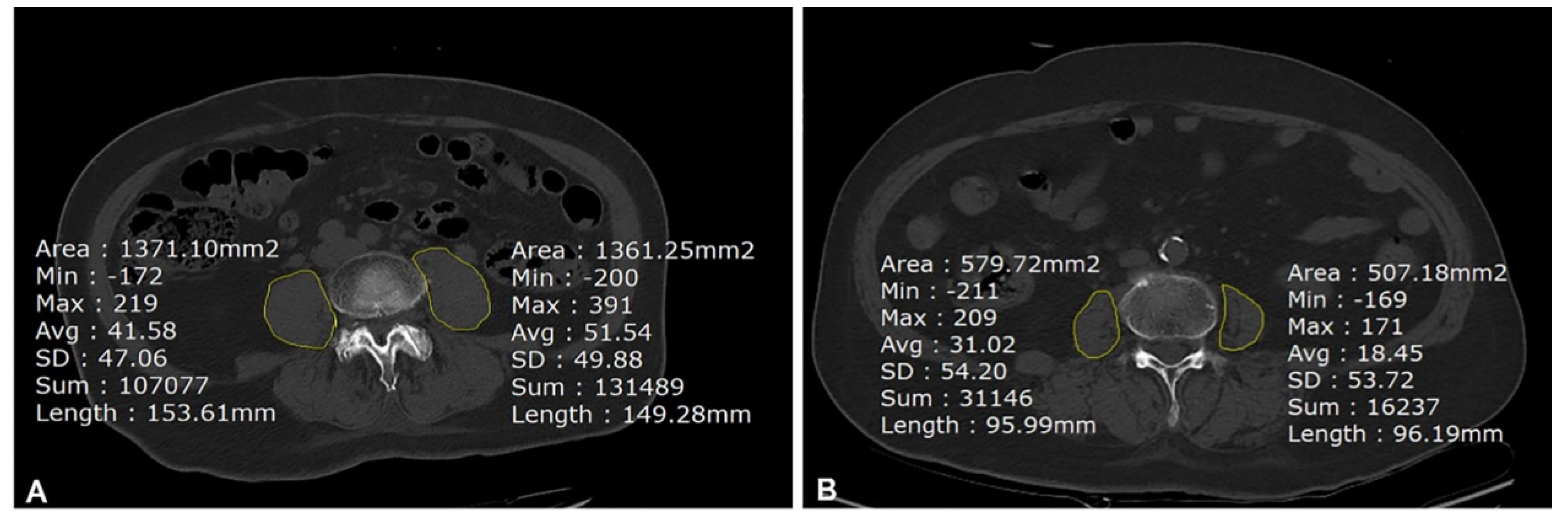 Jcm 12 01691 g002 Jcm 12 01691 g002