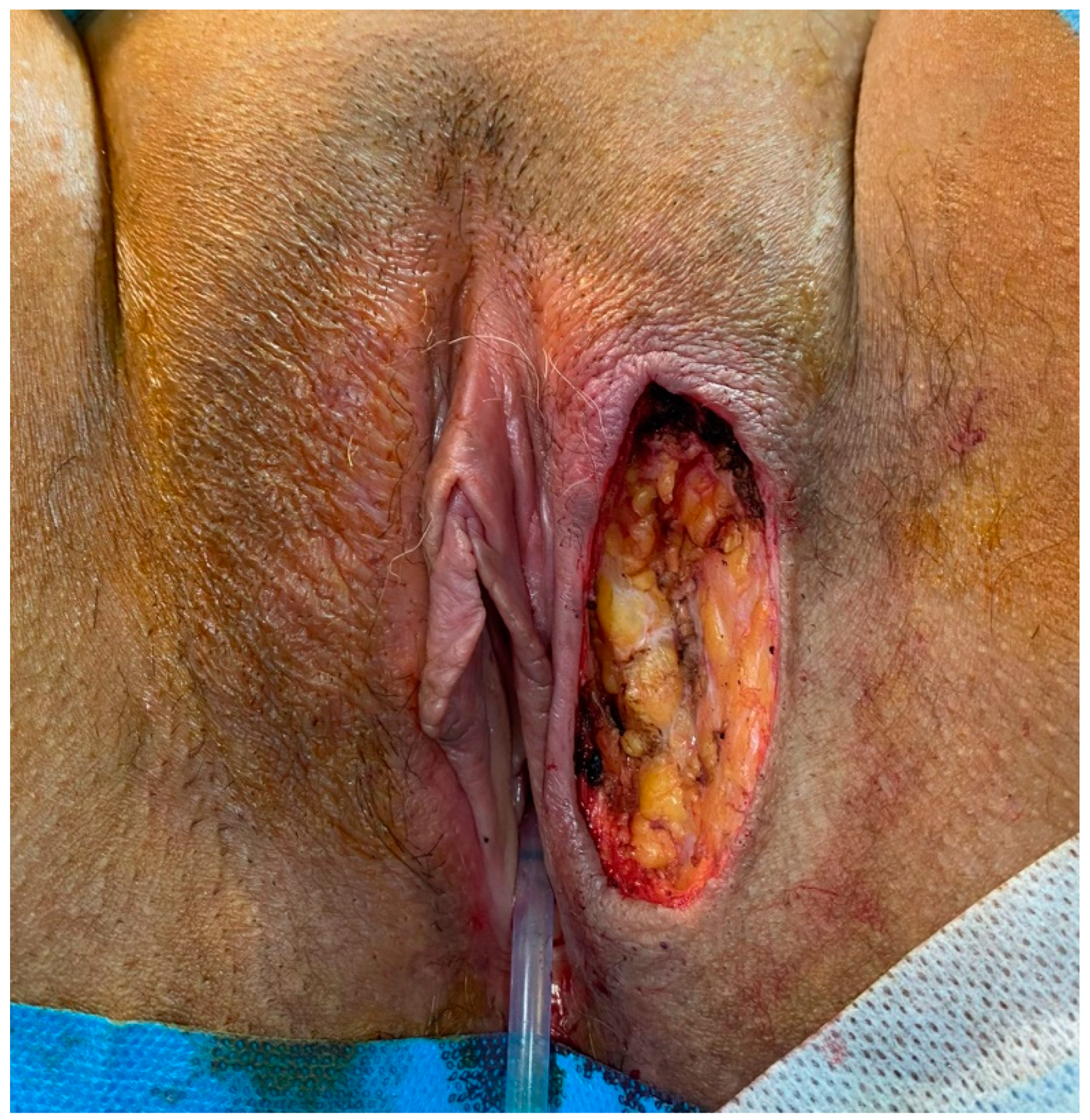 Jcm 12 01726 g004 Jcm 12 01726 g004