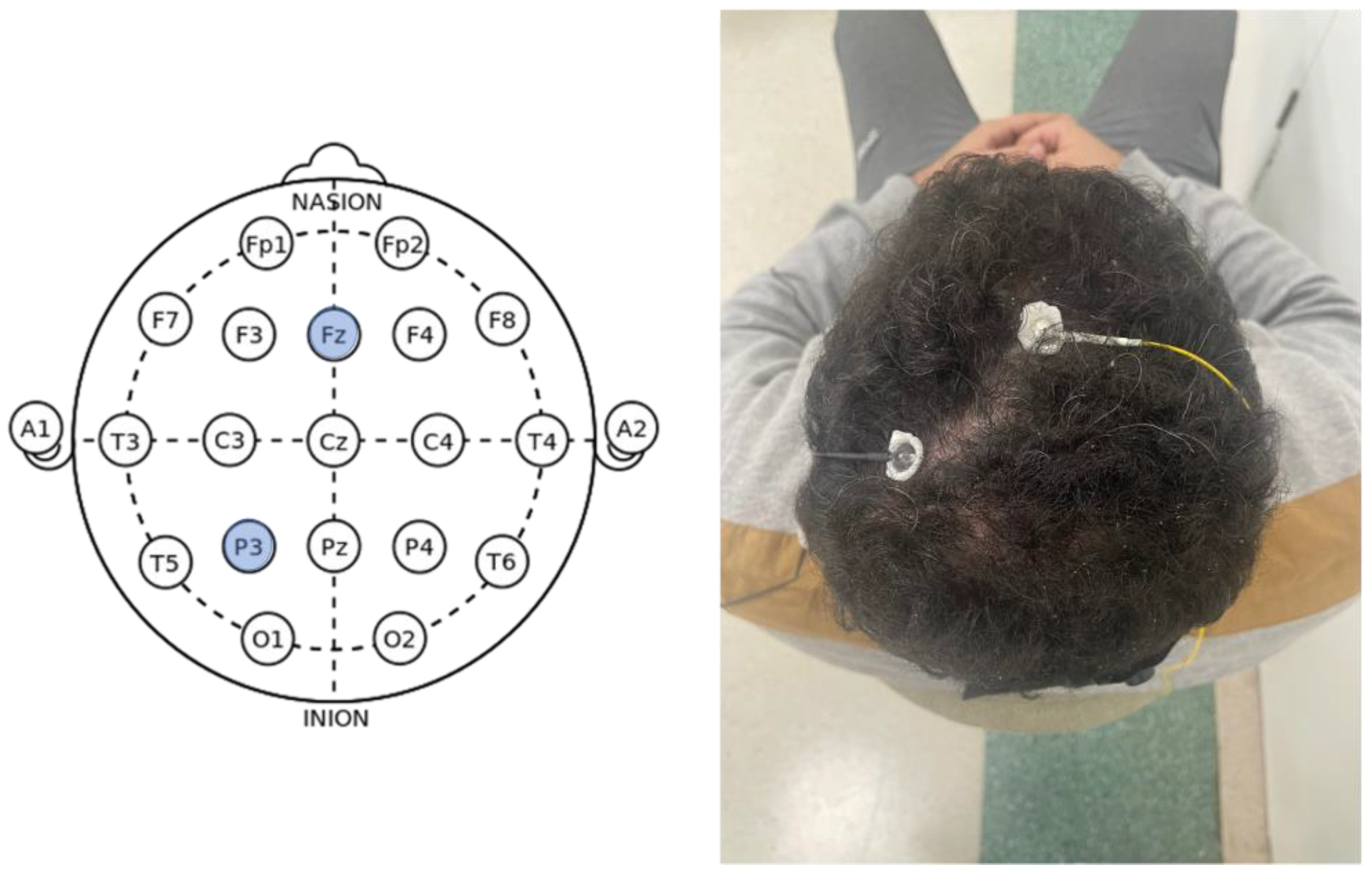 Jcm 12 01780 g003 Jcm 12 01780 g003