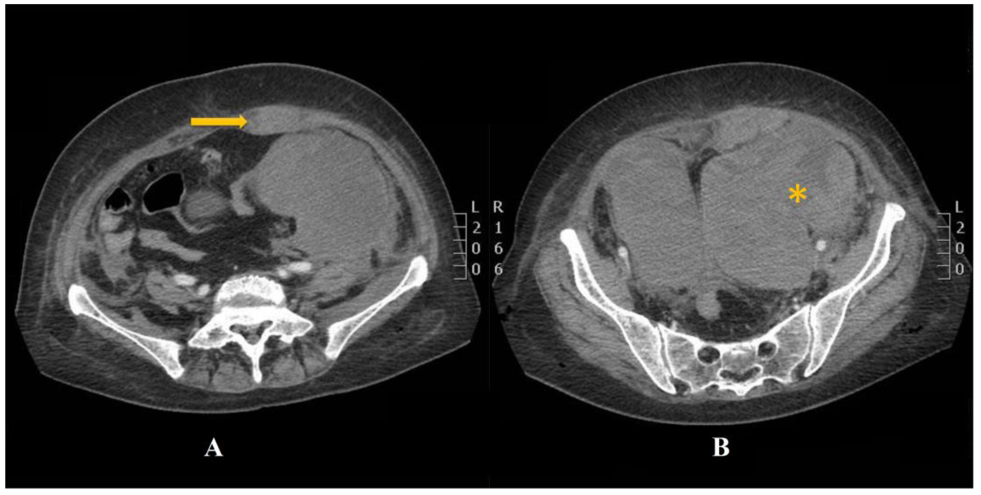 Jcm 12 01842 g002 Jcm 12 01842 g002