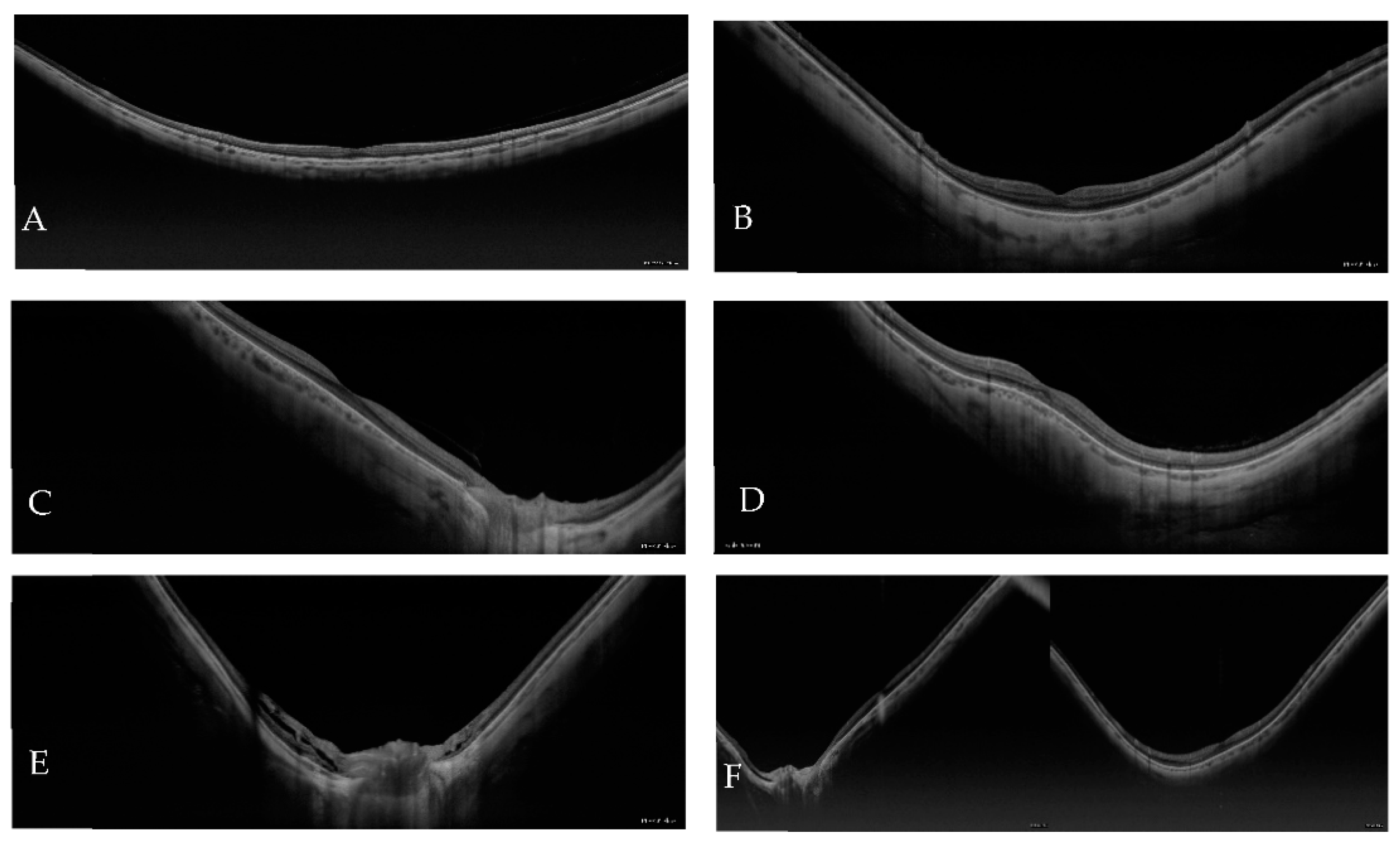 Jcm 12 01846 g002 Jcm 12 01846 g002