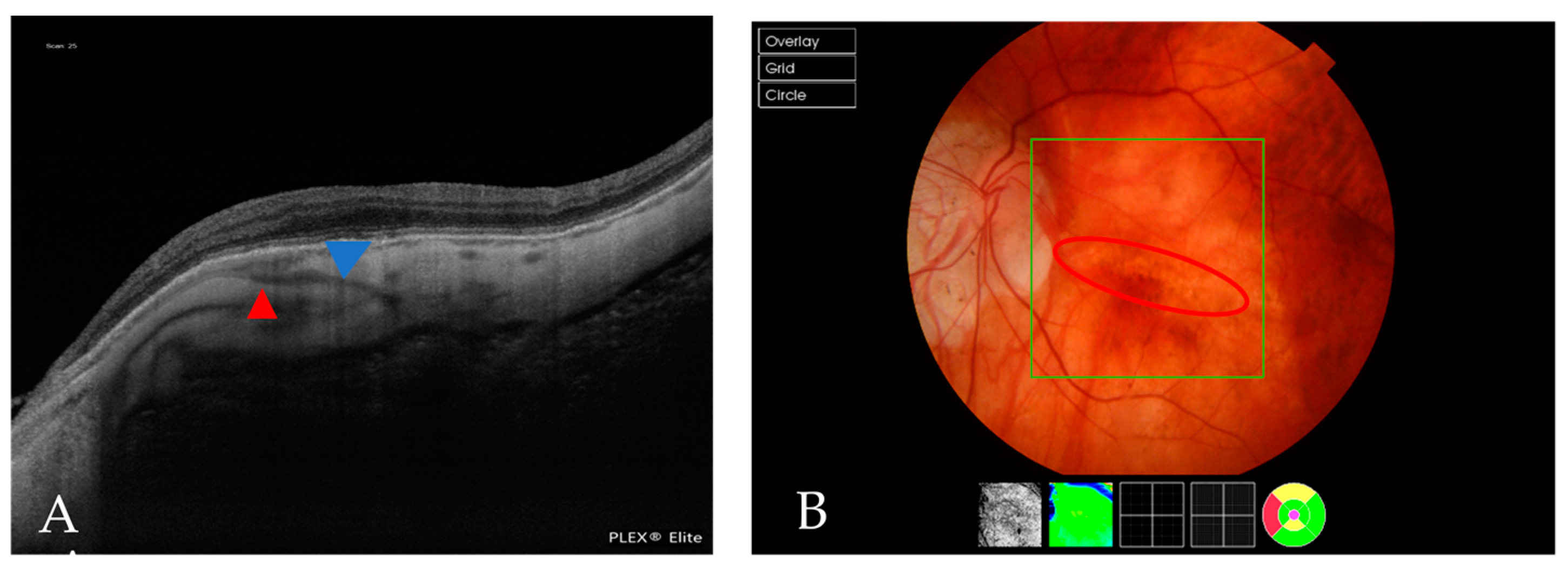 Jcm 12 01846 g004 Jcm 12 01846 g004