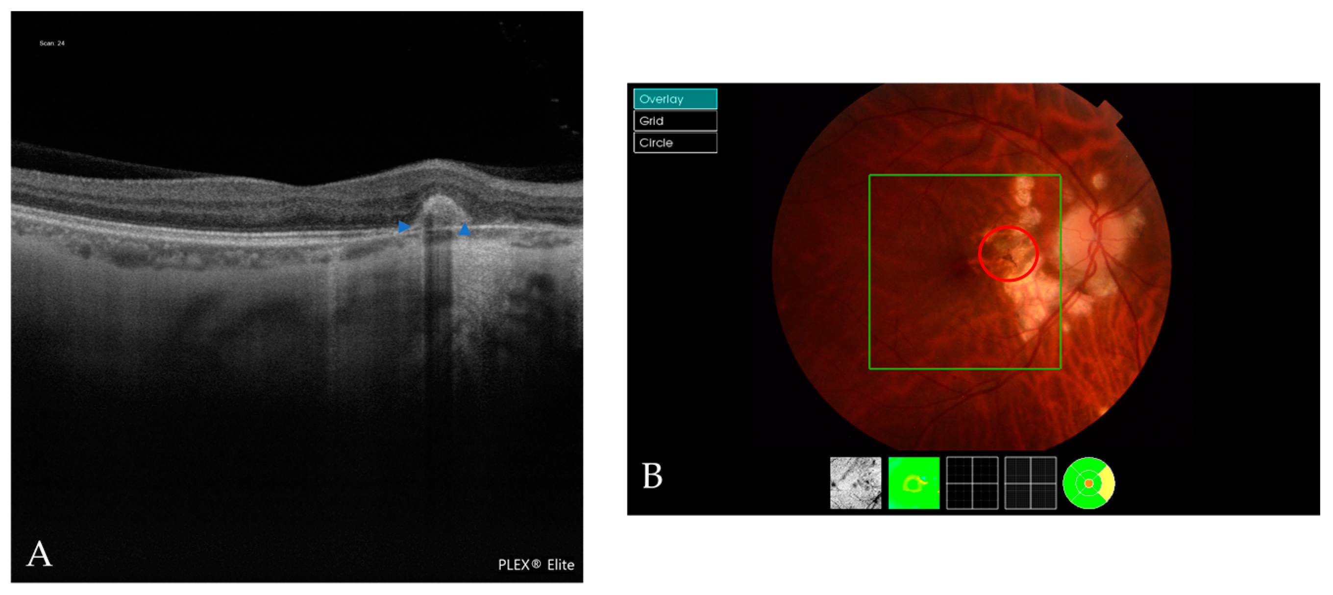 Jcm 12 01846 g006 Jcm 12 01846 g006