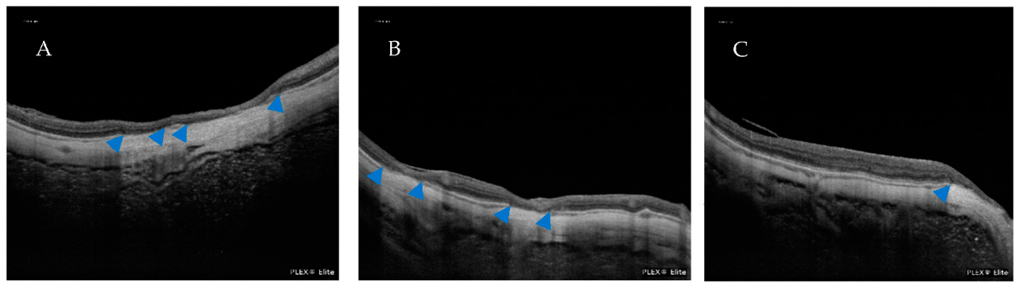 Jcm 12 01846 g007 Jcm 12 01846 g007