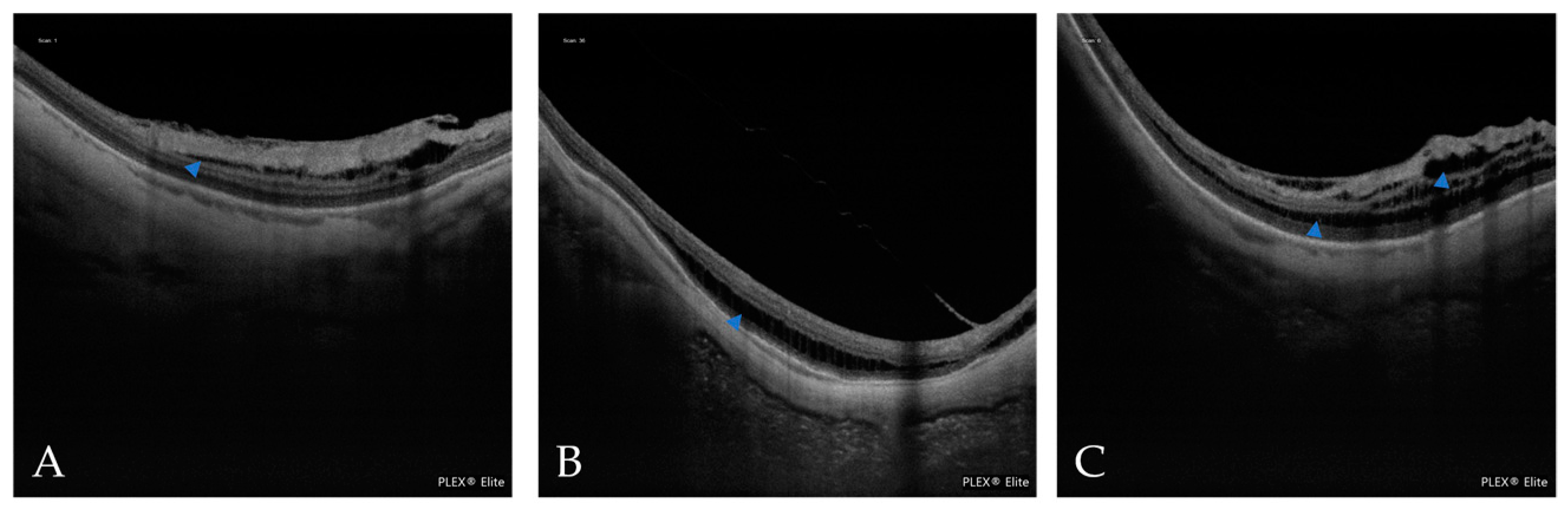 Jcm 12 01846 g008 Jcm 12 01846 g008