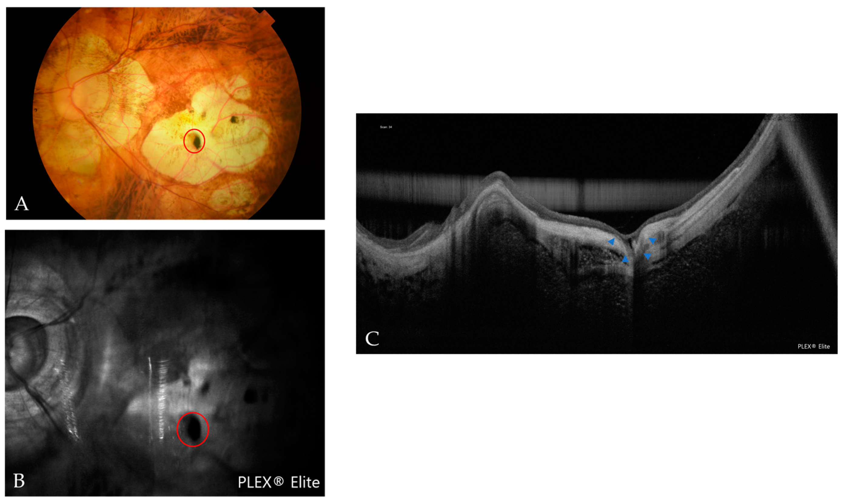 Jcm 12 01846 g010 Jcm 12 01846 g010
